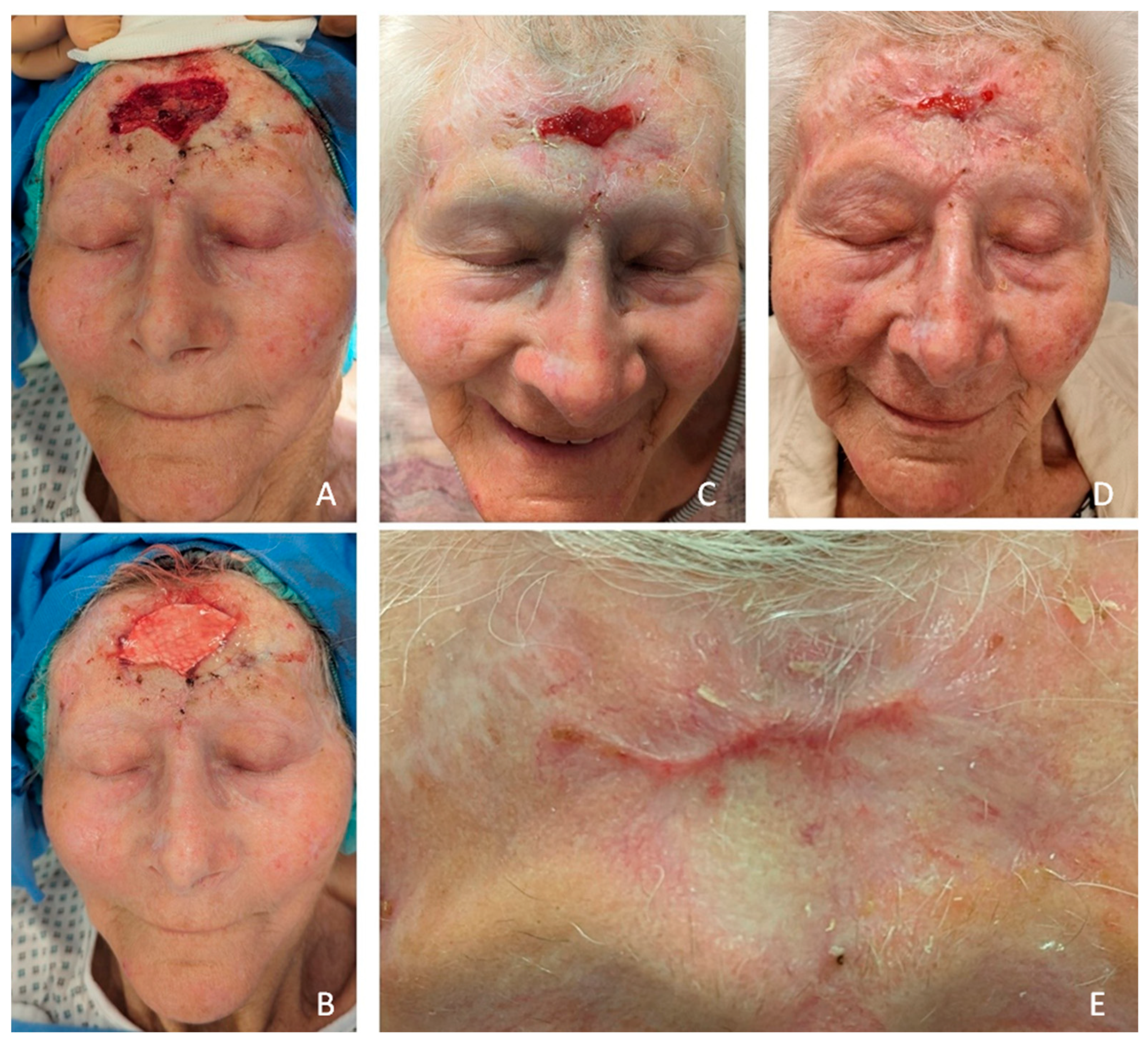 Preprints 139846 g003