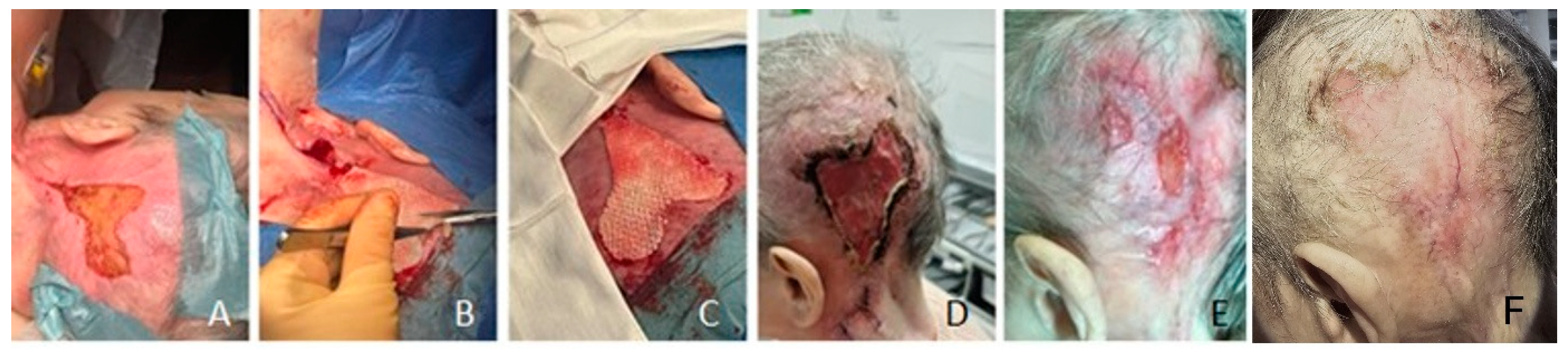 Preprints 139846 g004