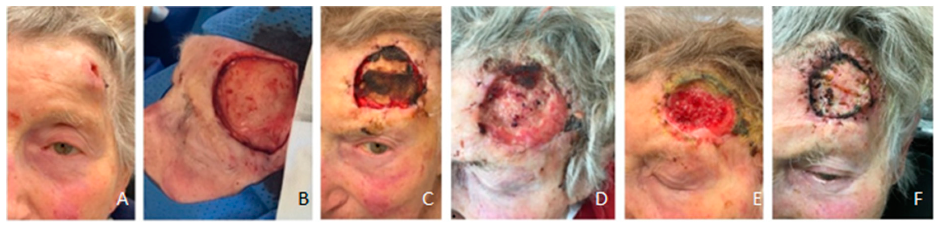 Preprints 139846 g005