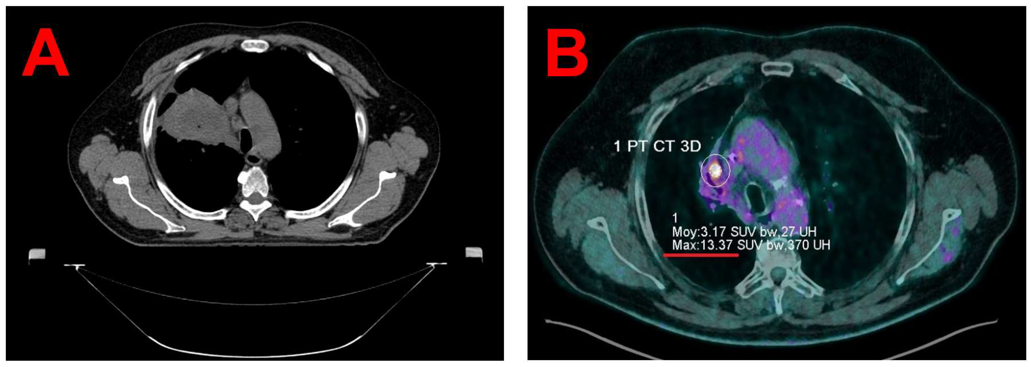 Preprints 155207 g001