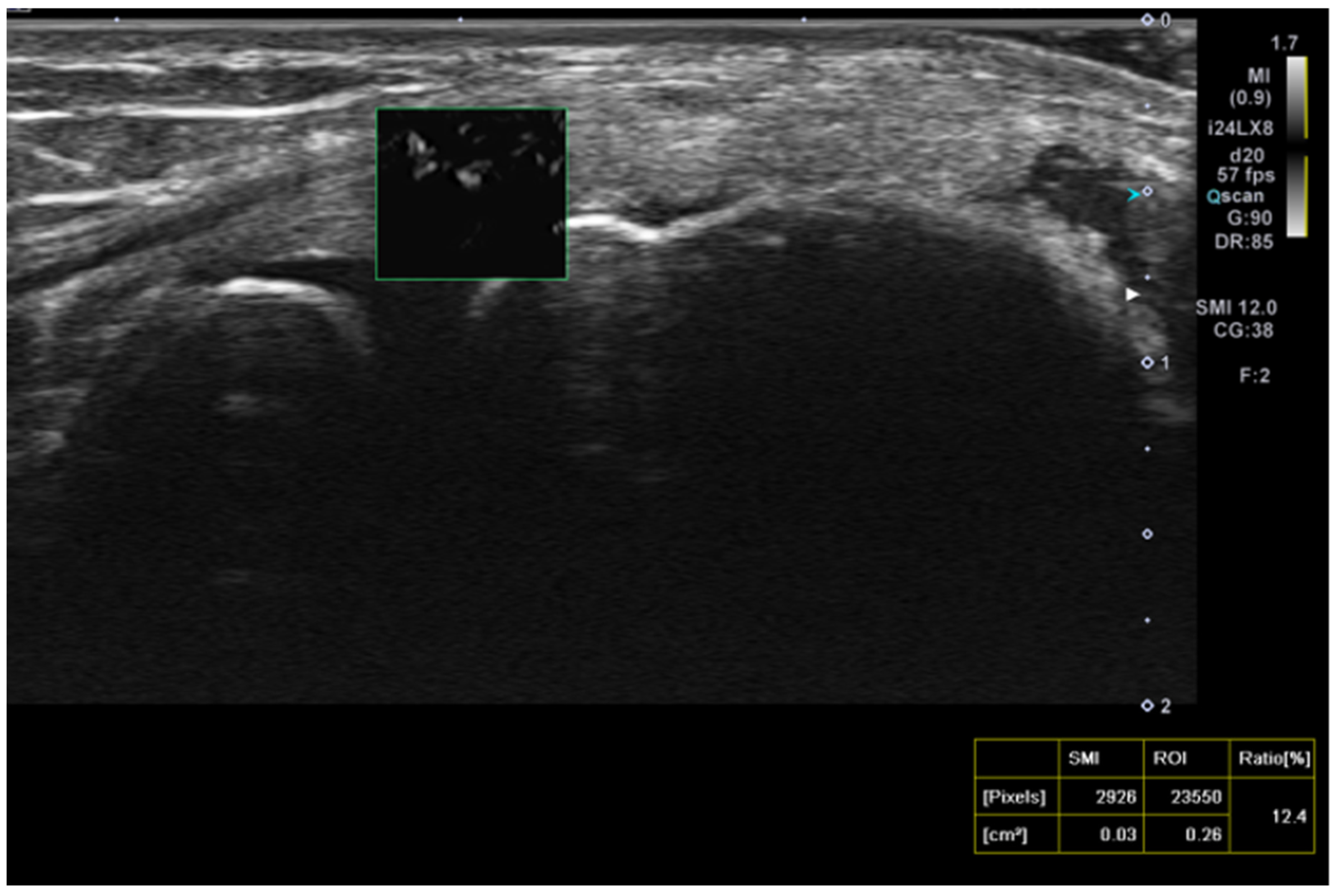 Preprints 157442 g003
