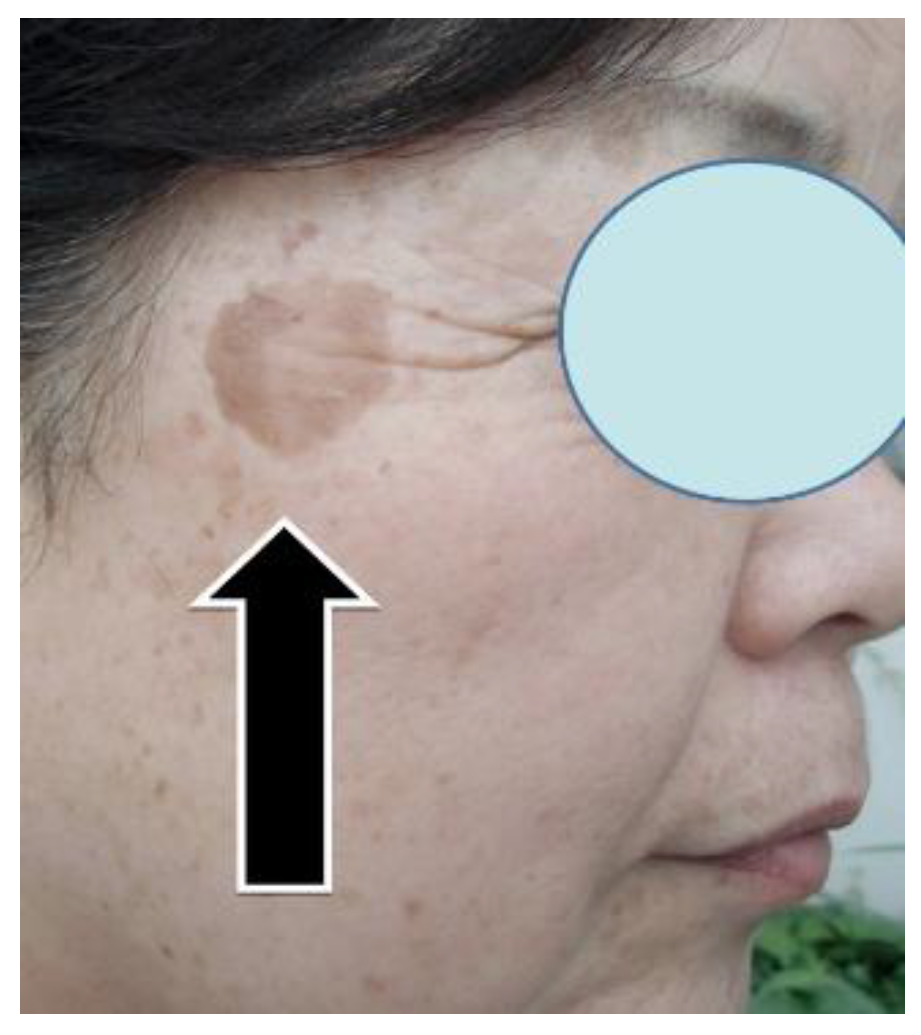 Preprints 121950 g100