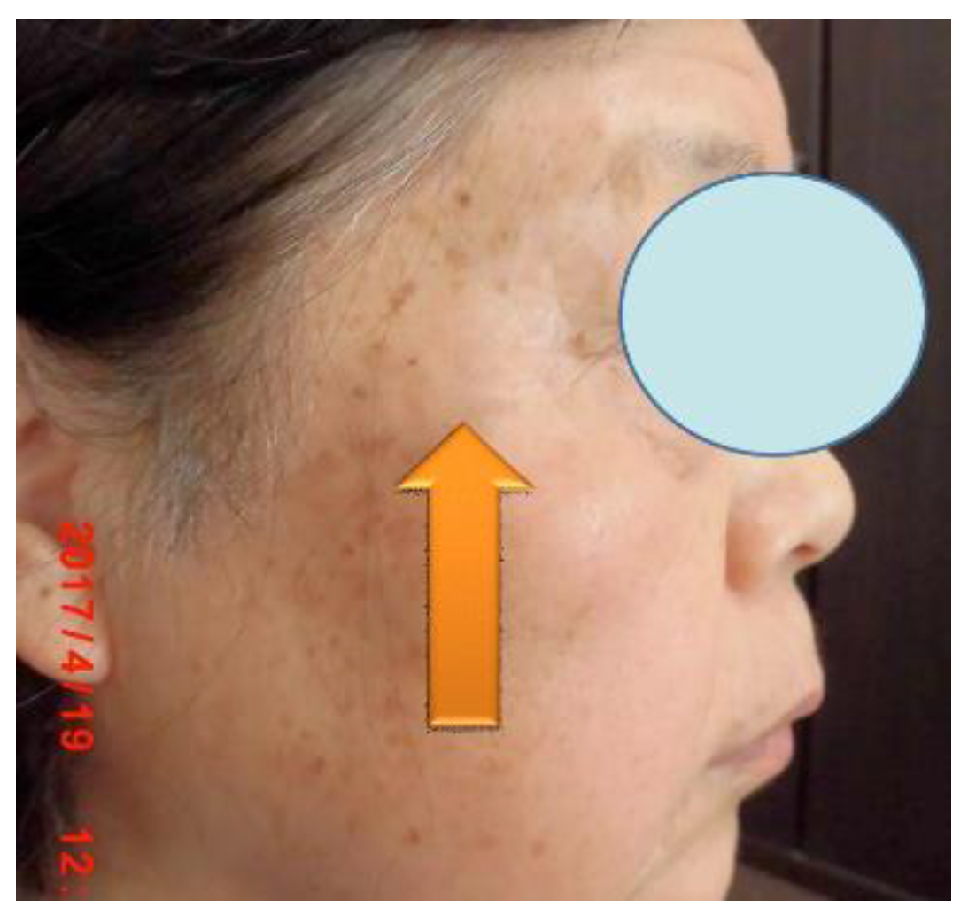 Preprints 121950 g101