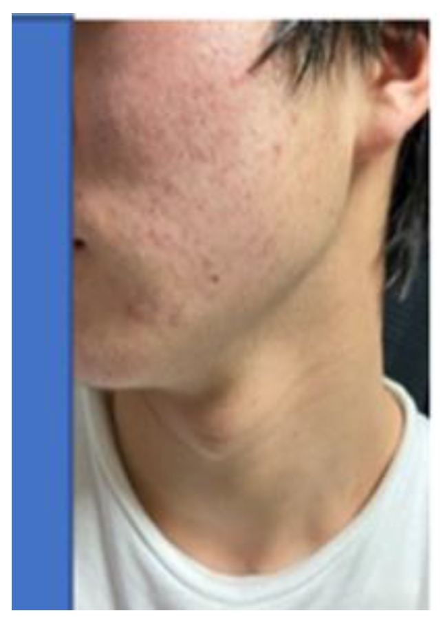 Preprints 121950 g103