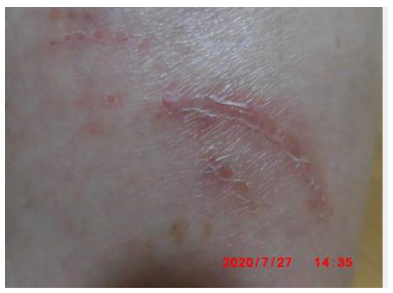 Preprints 121950 g106