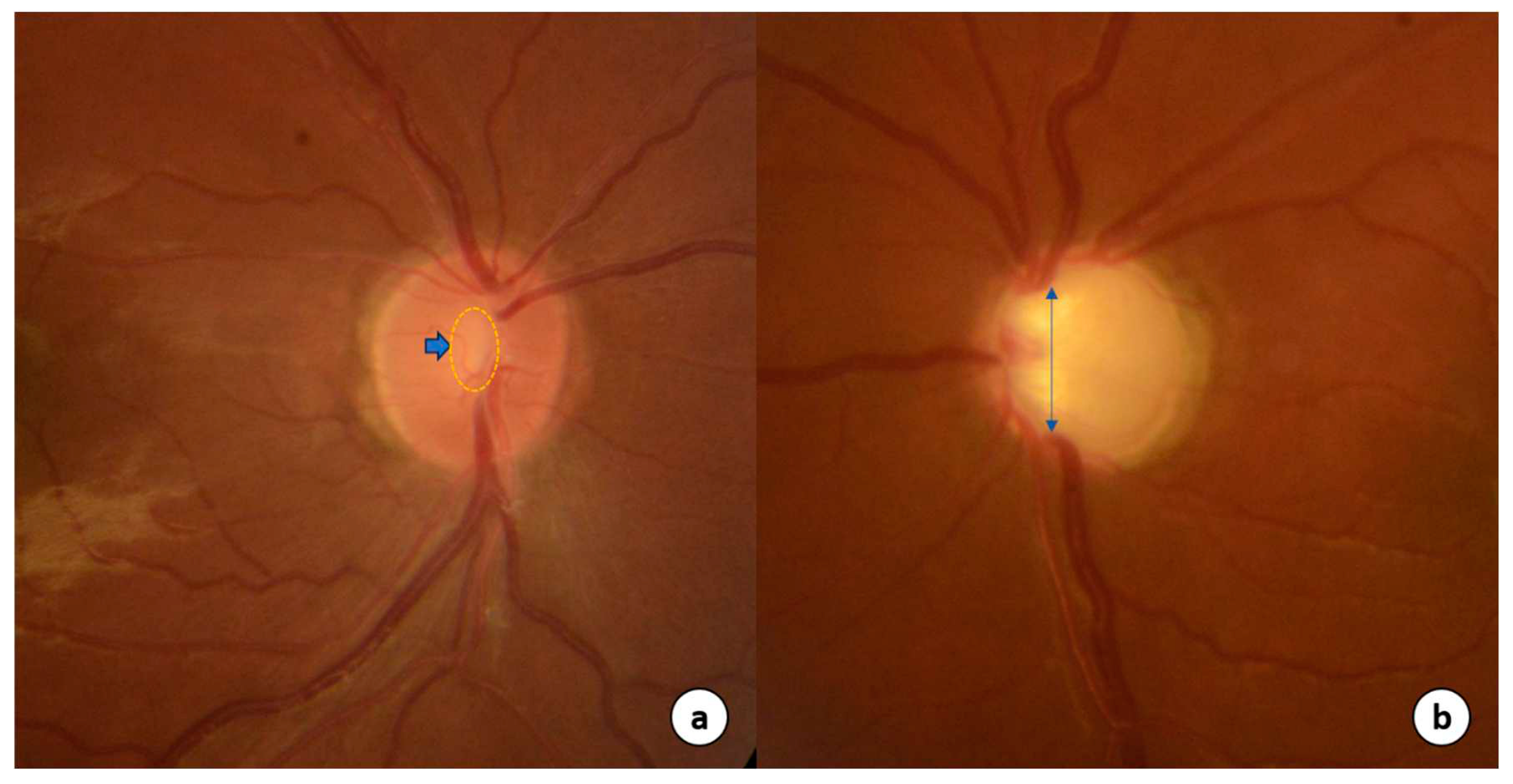 Preprints 80914 g001