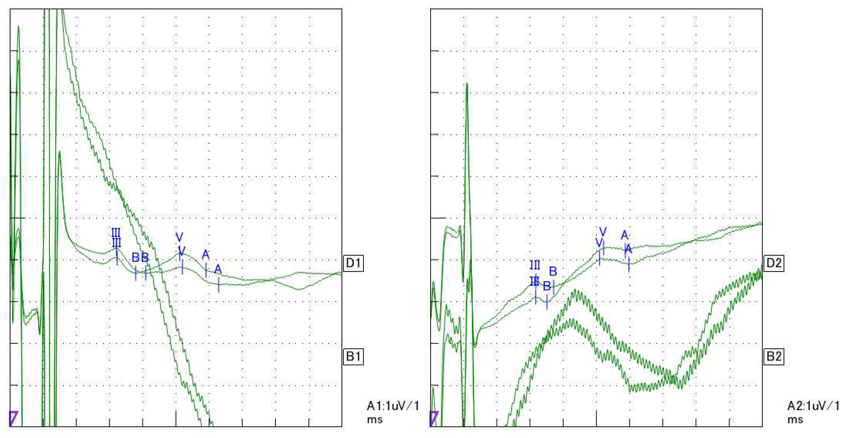 Preprints 93111 g005