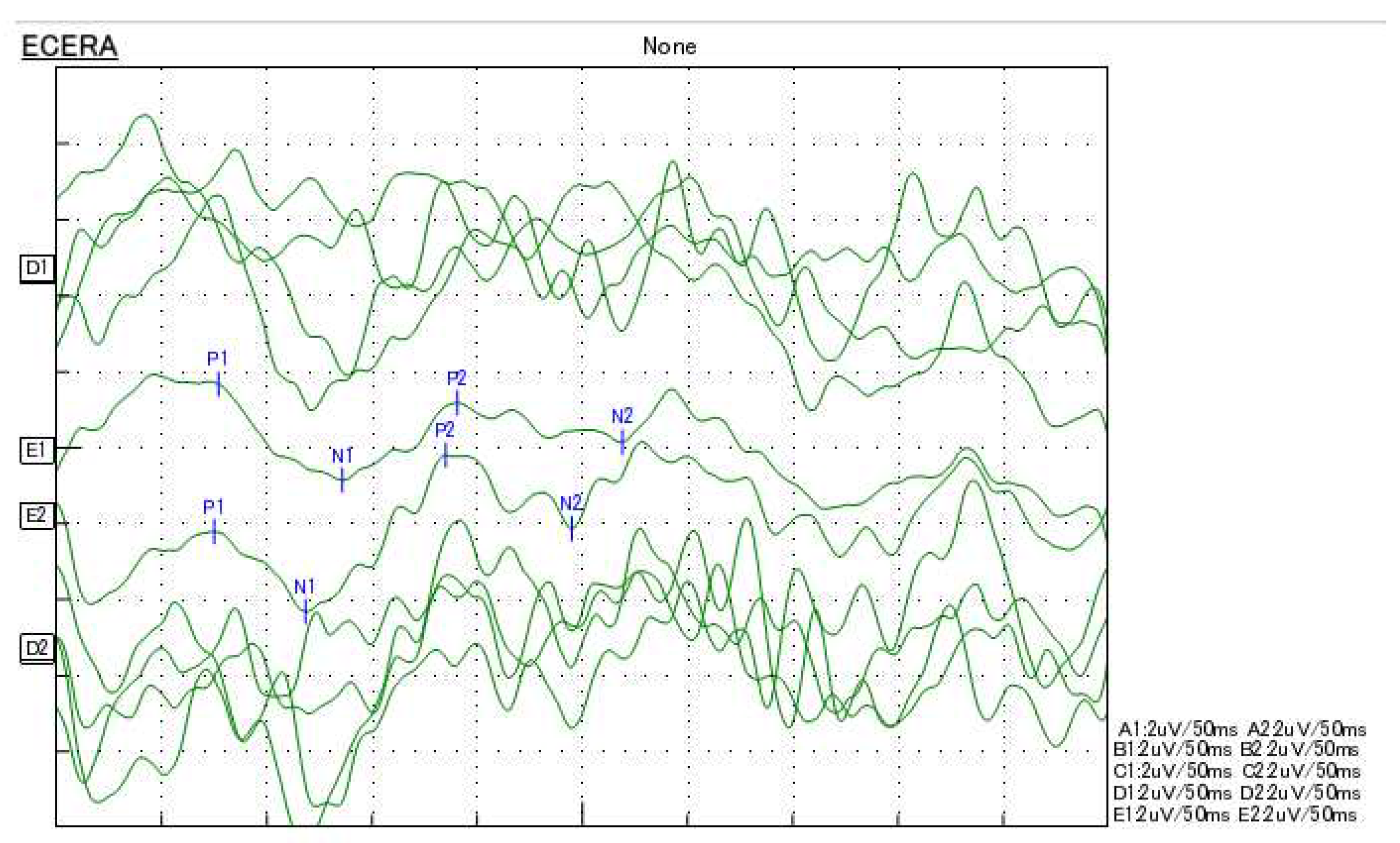 Preprints 93111 g006