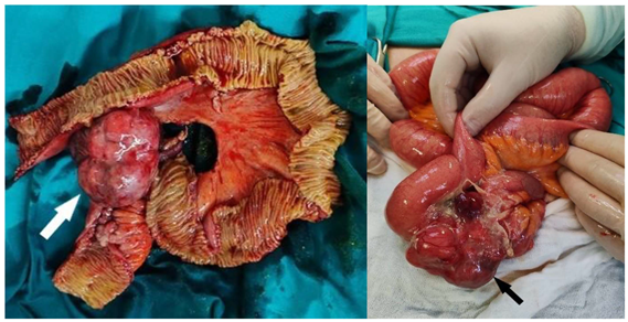 Preprints 157765 i001