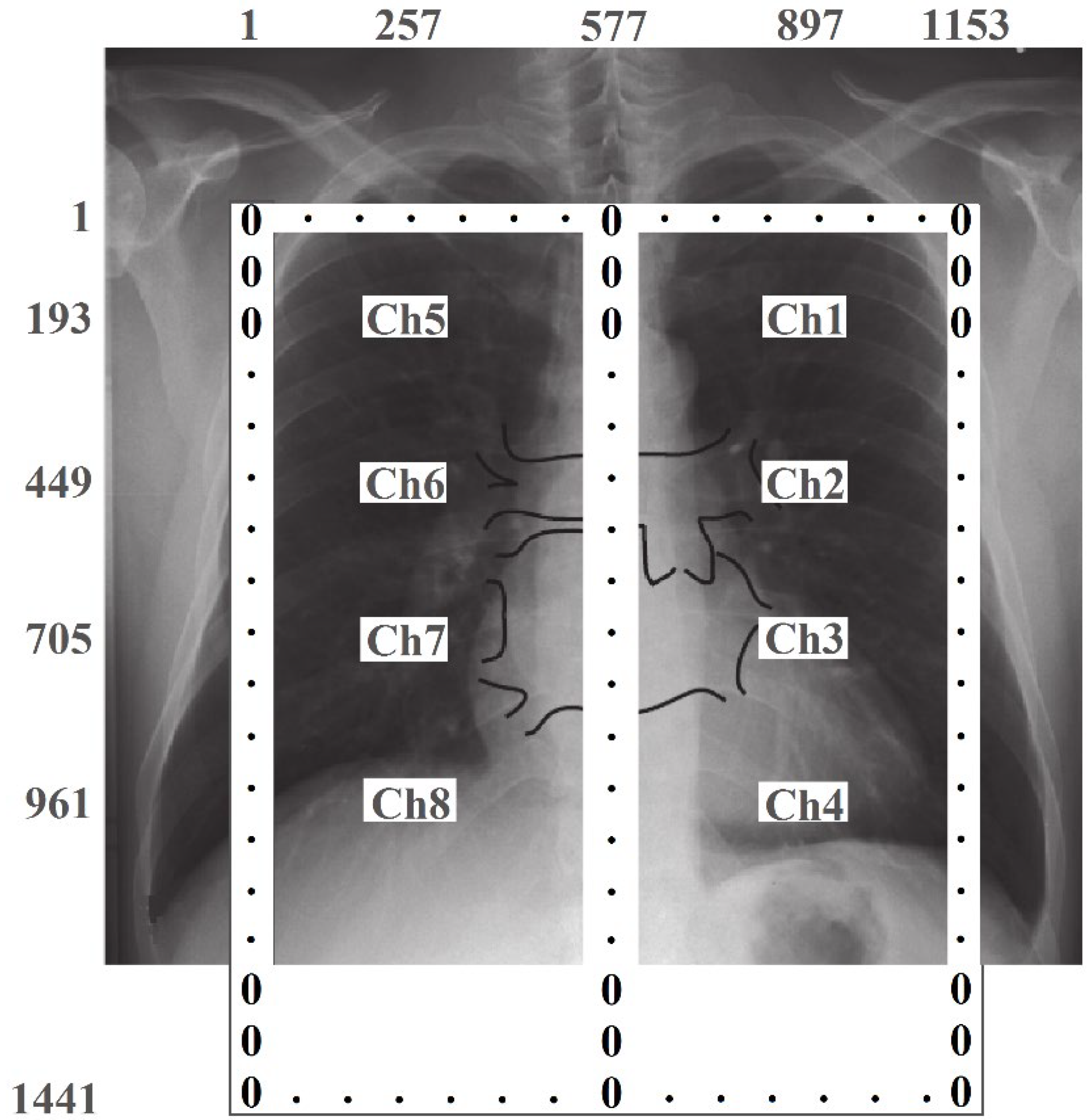 Preprints 118038 g011