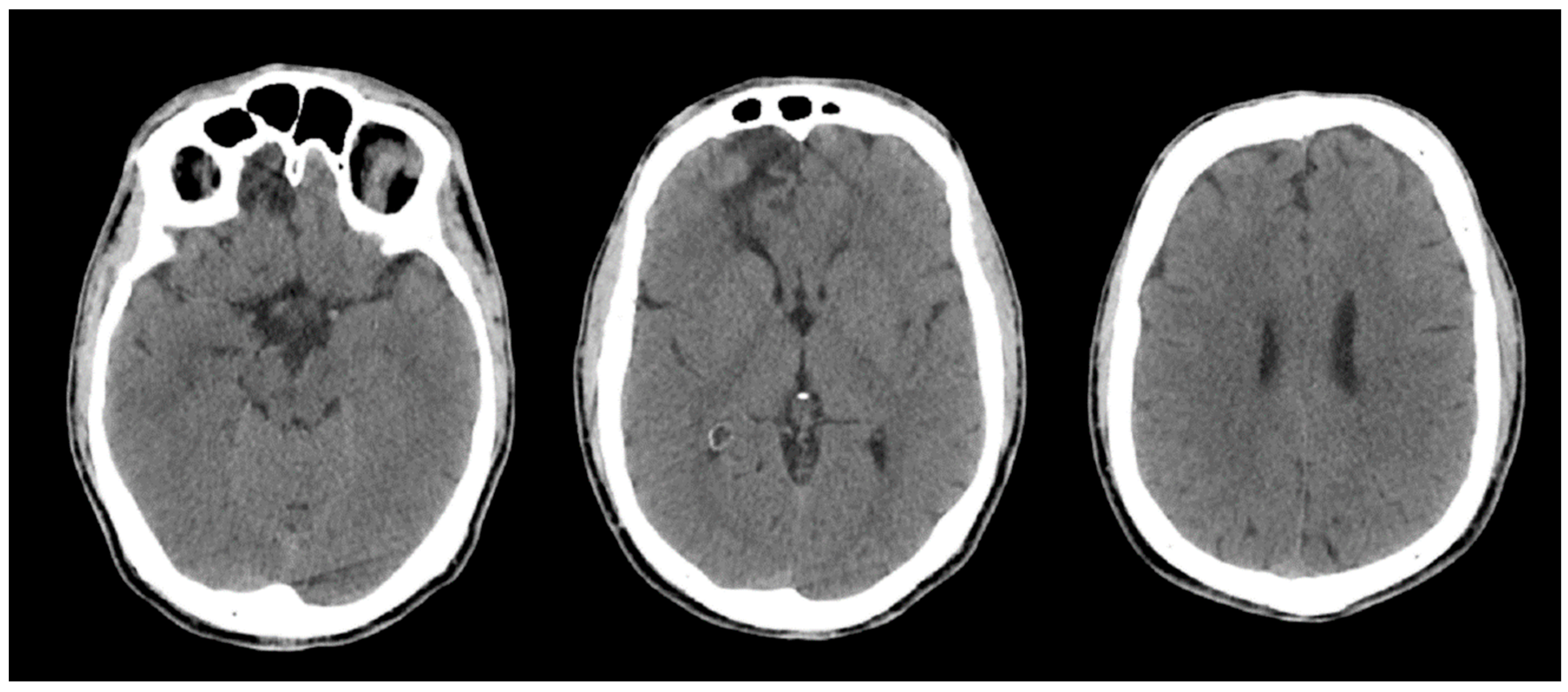 Preprints 194157 g002