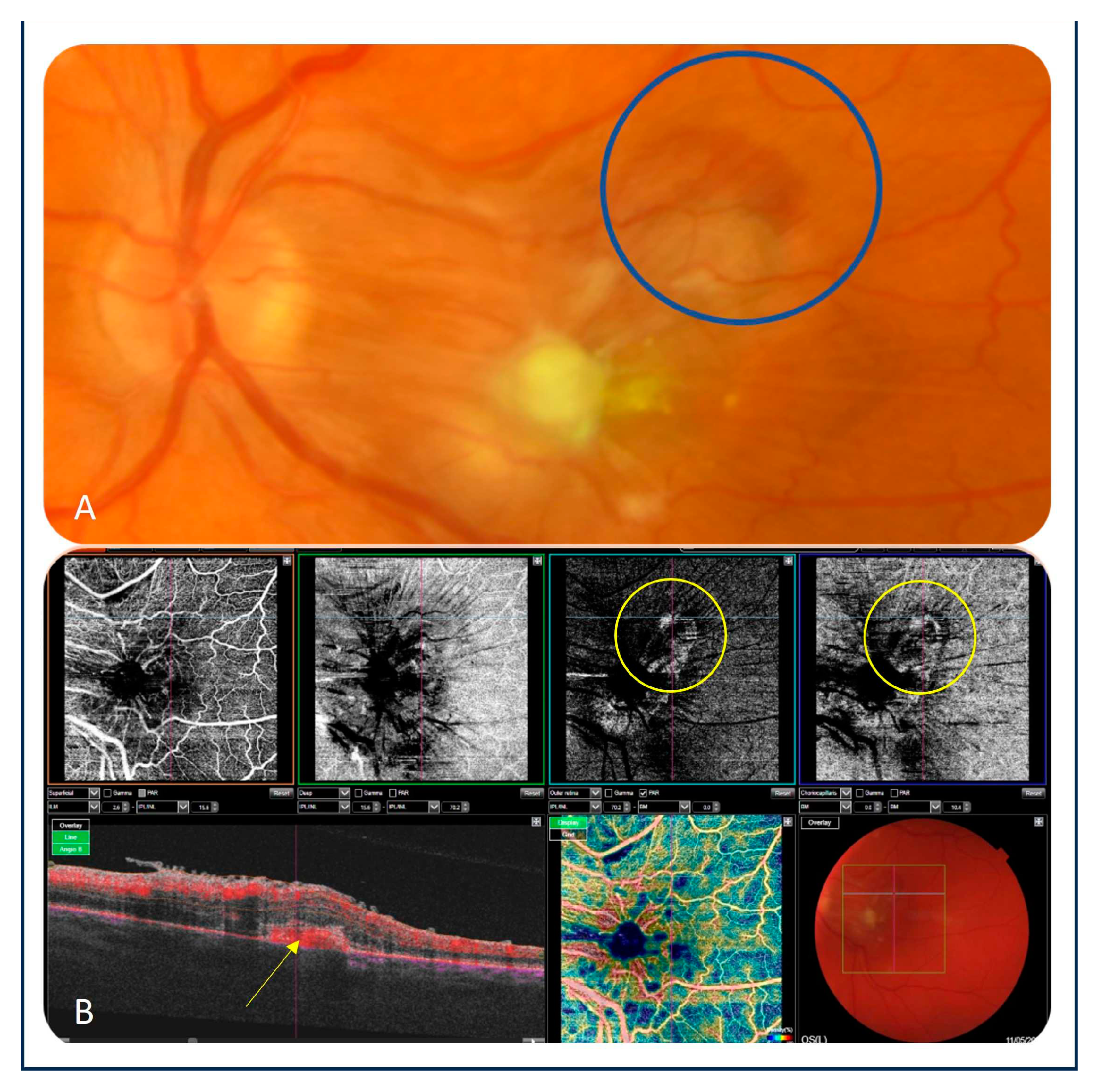 Preprints 92411 g003