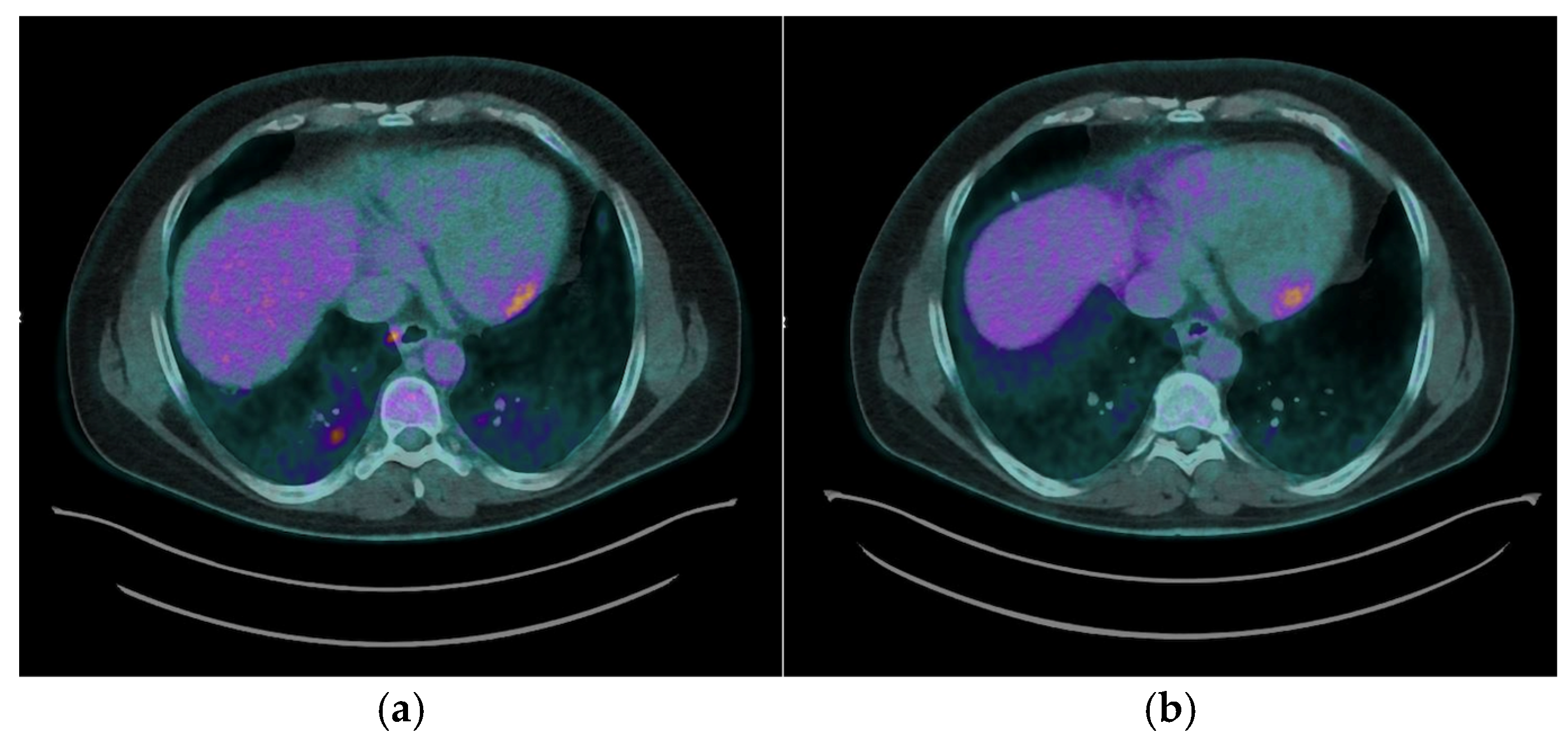 Preprints 167364 g005