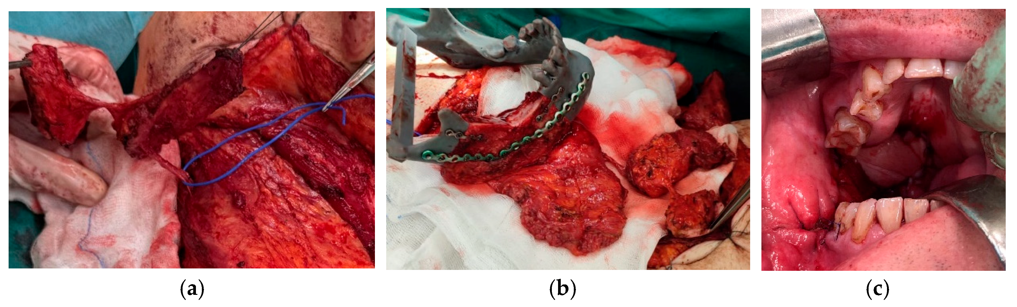 Preprints 172886 g003