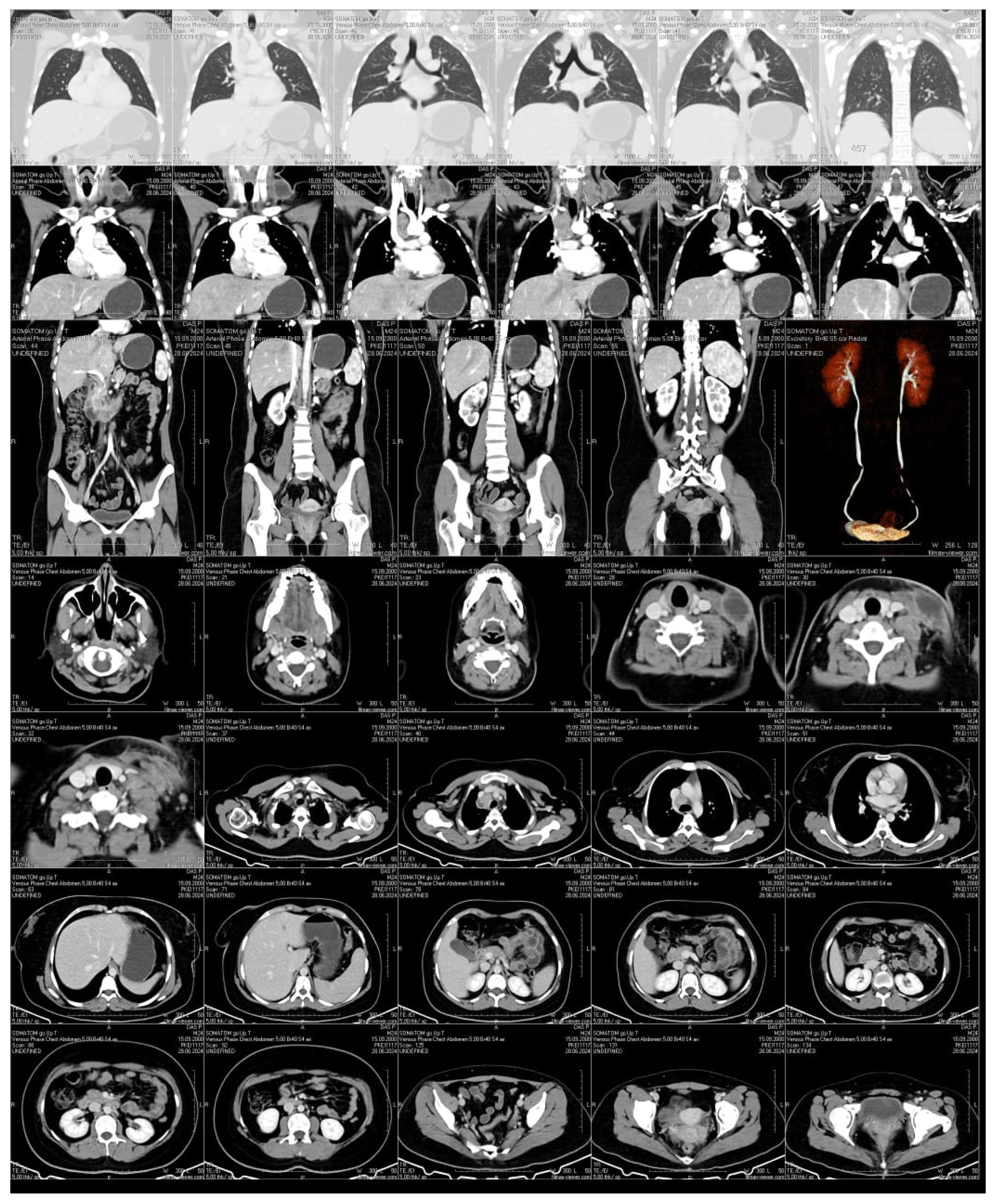 Preprints 149068 g002