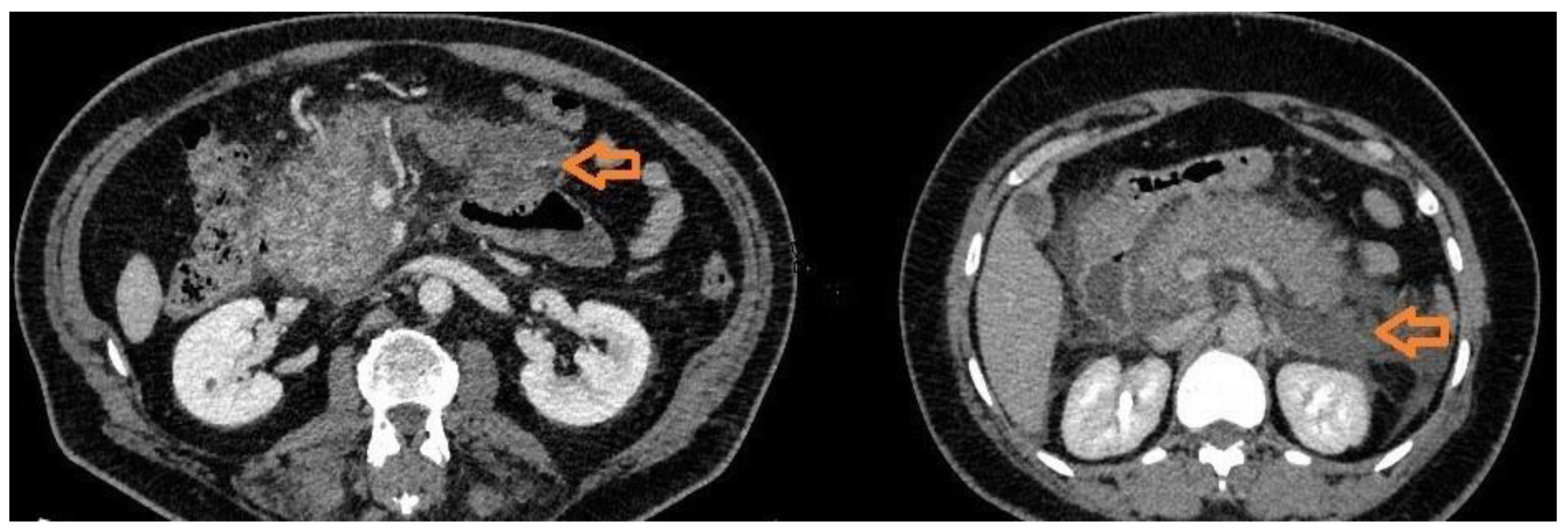 Preprints 150817 g001