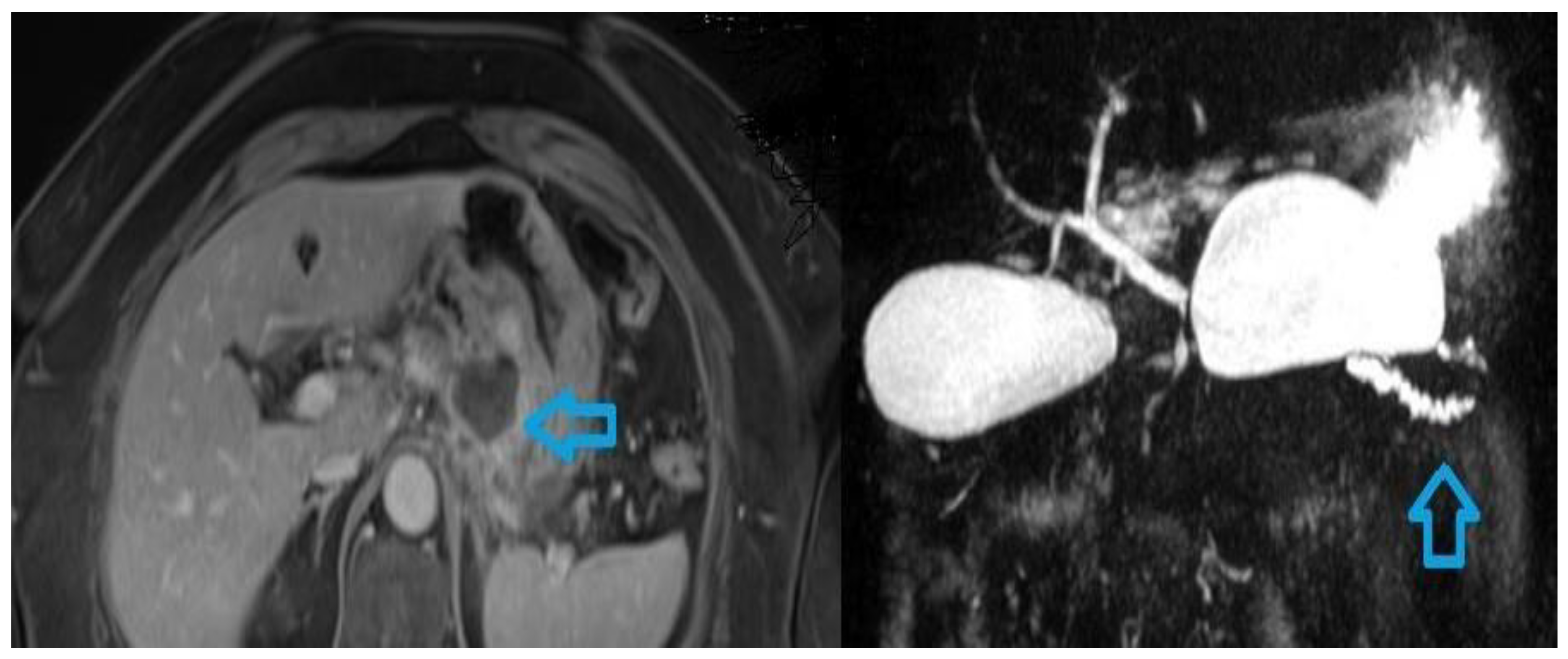 Preprints 150817 g002