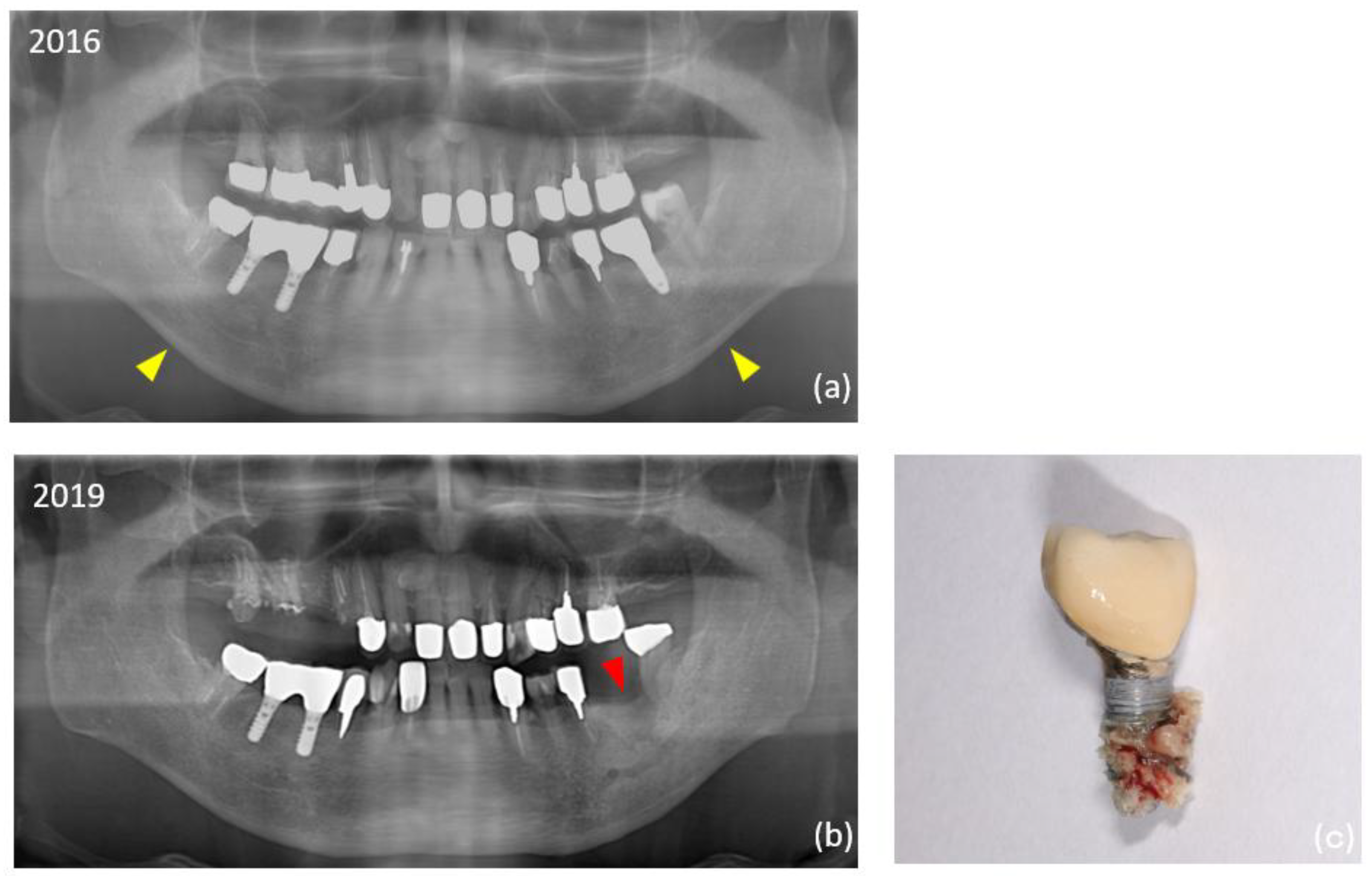 Preprints 163630 g002