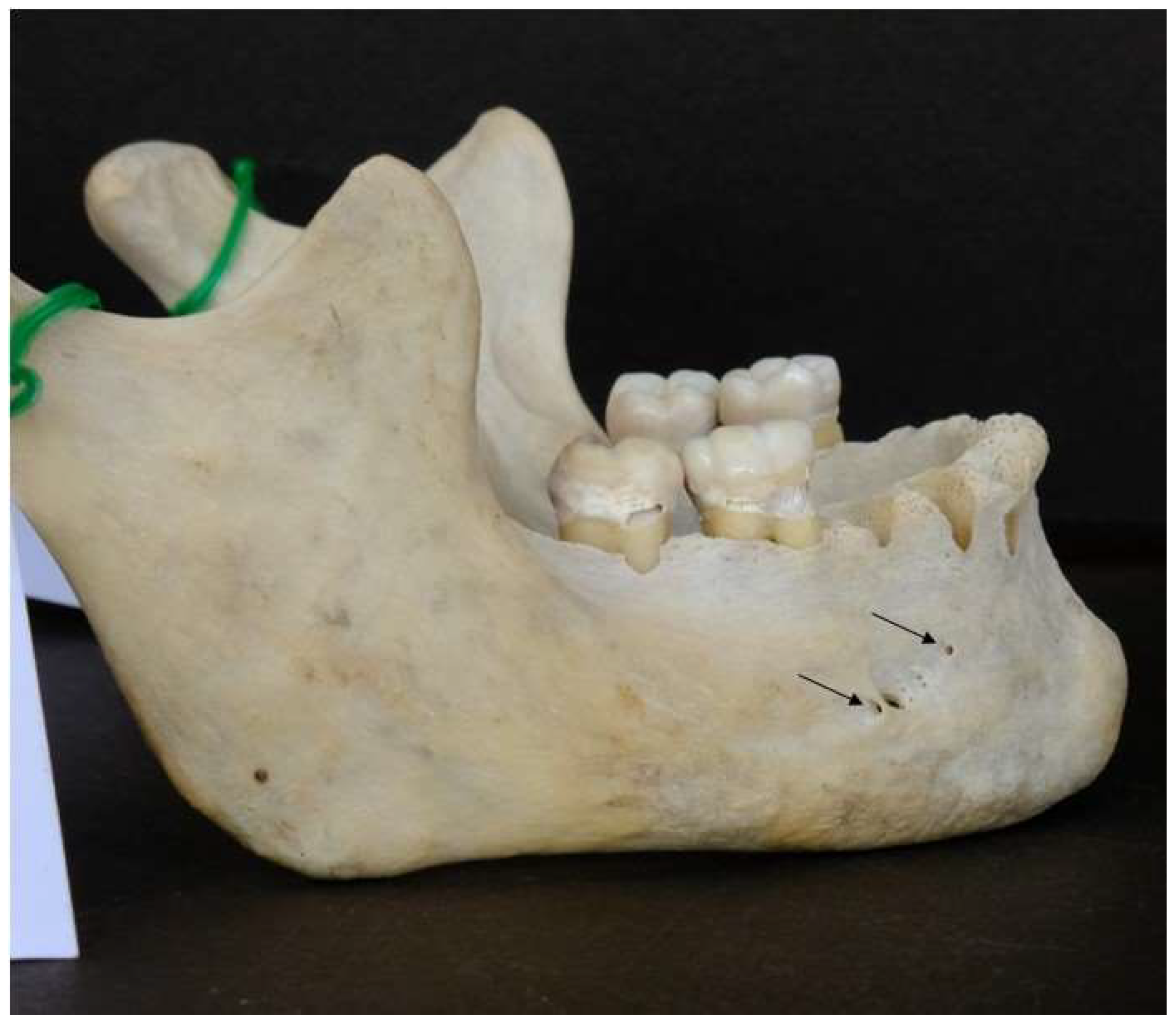 Preprints 146120 g002