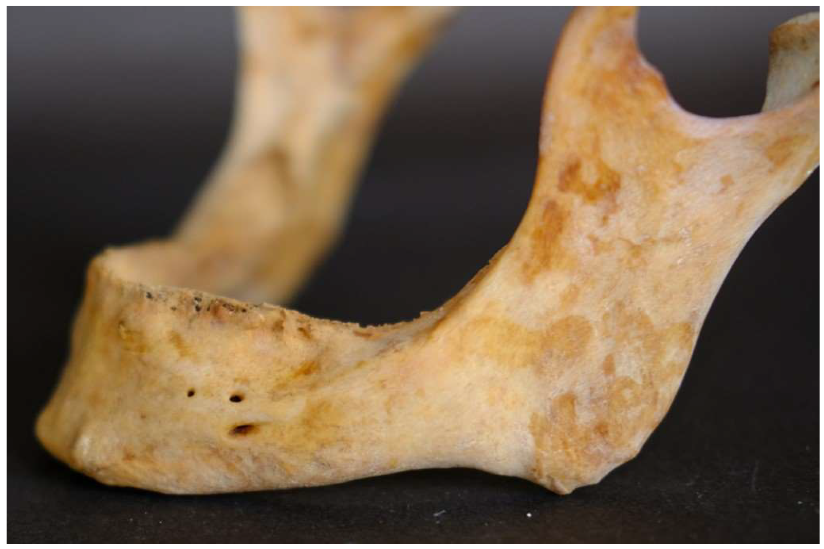 Preprints 146120 g003