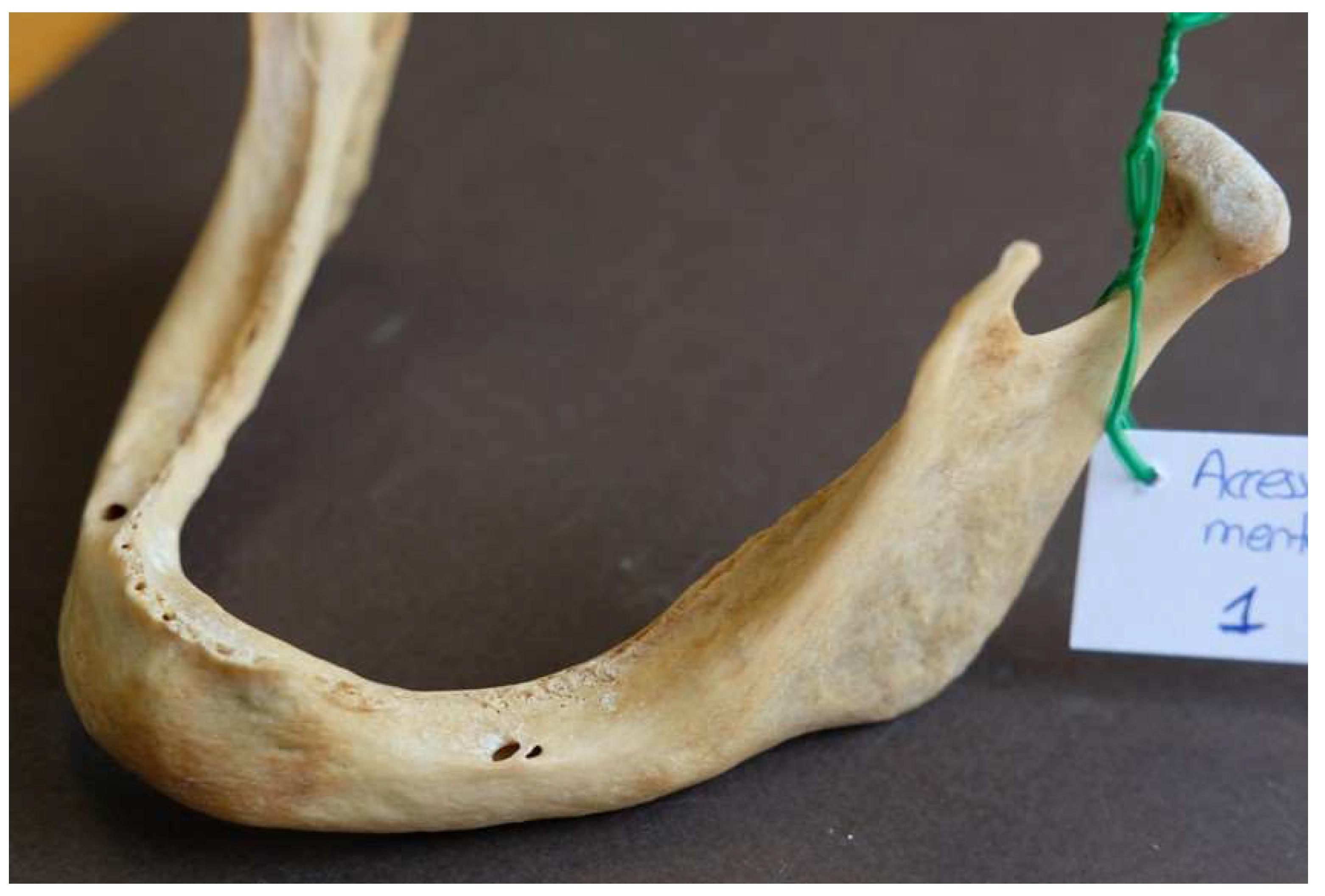 Preprints 146120 g004