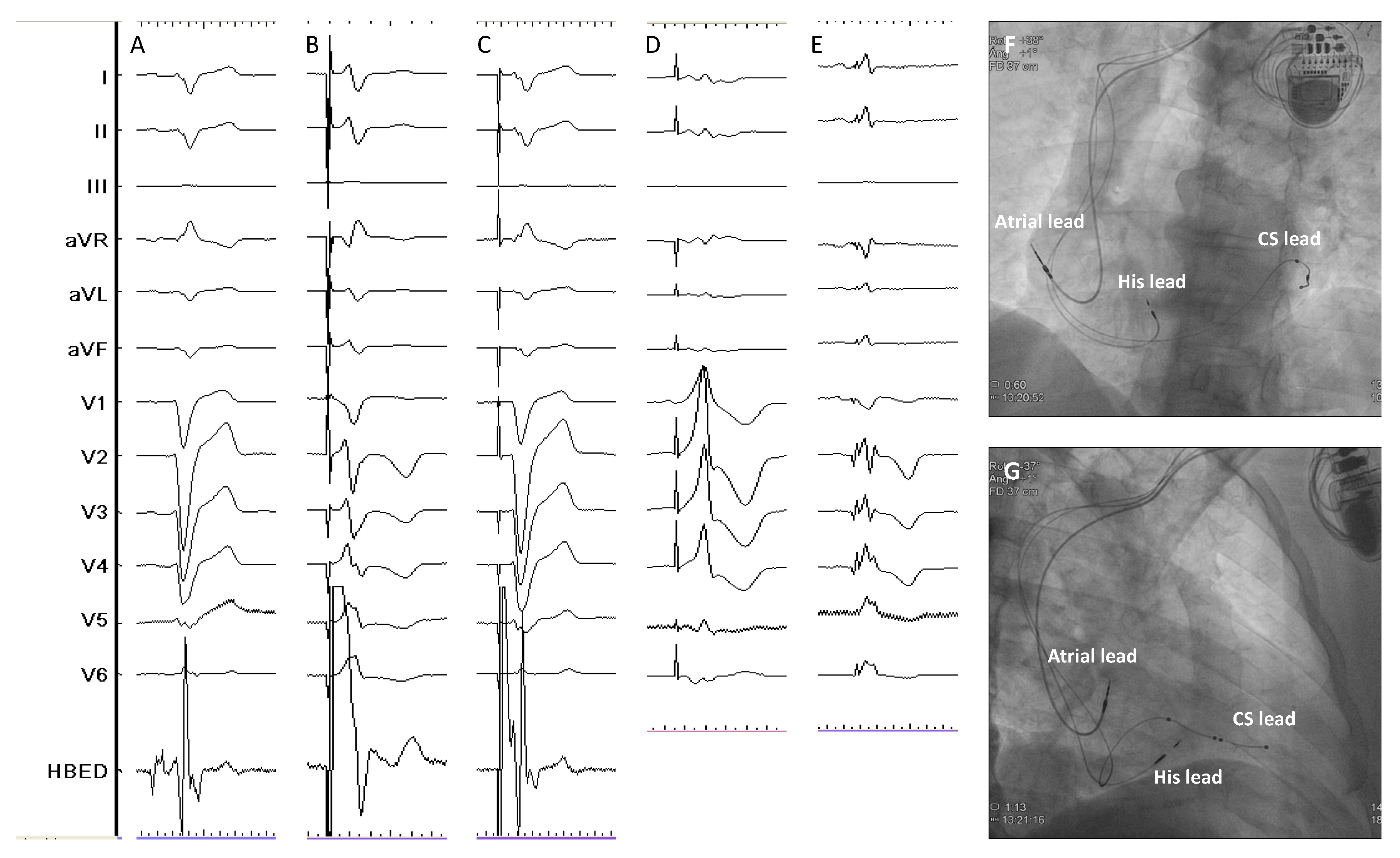 Preprints 85513 g005