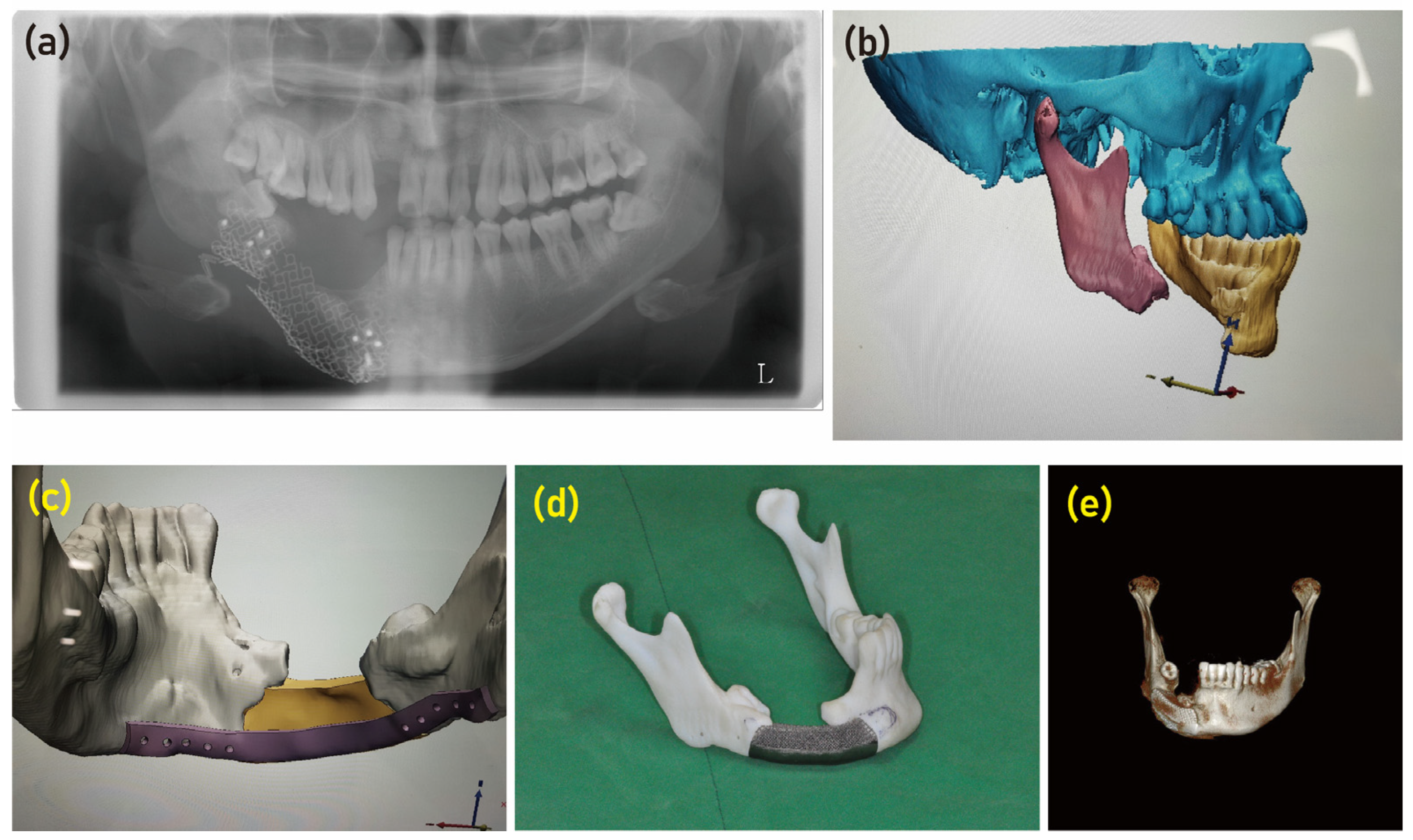 Preprints 81164 g003