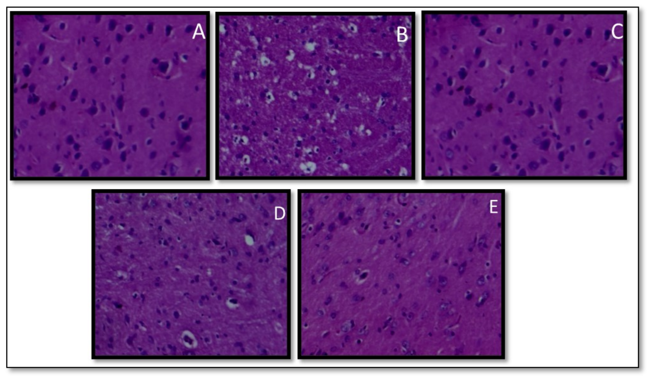 Preprints 225288 g009