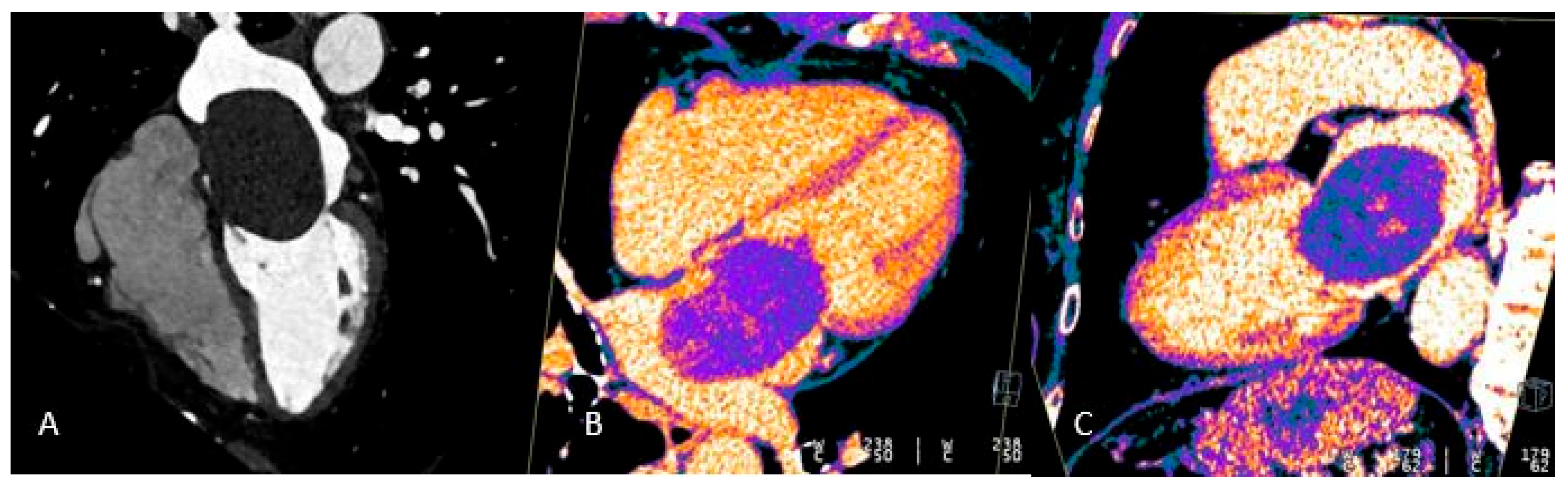 Preprints 175995 g006