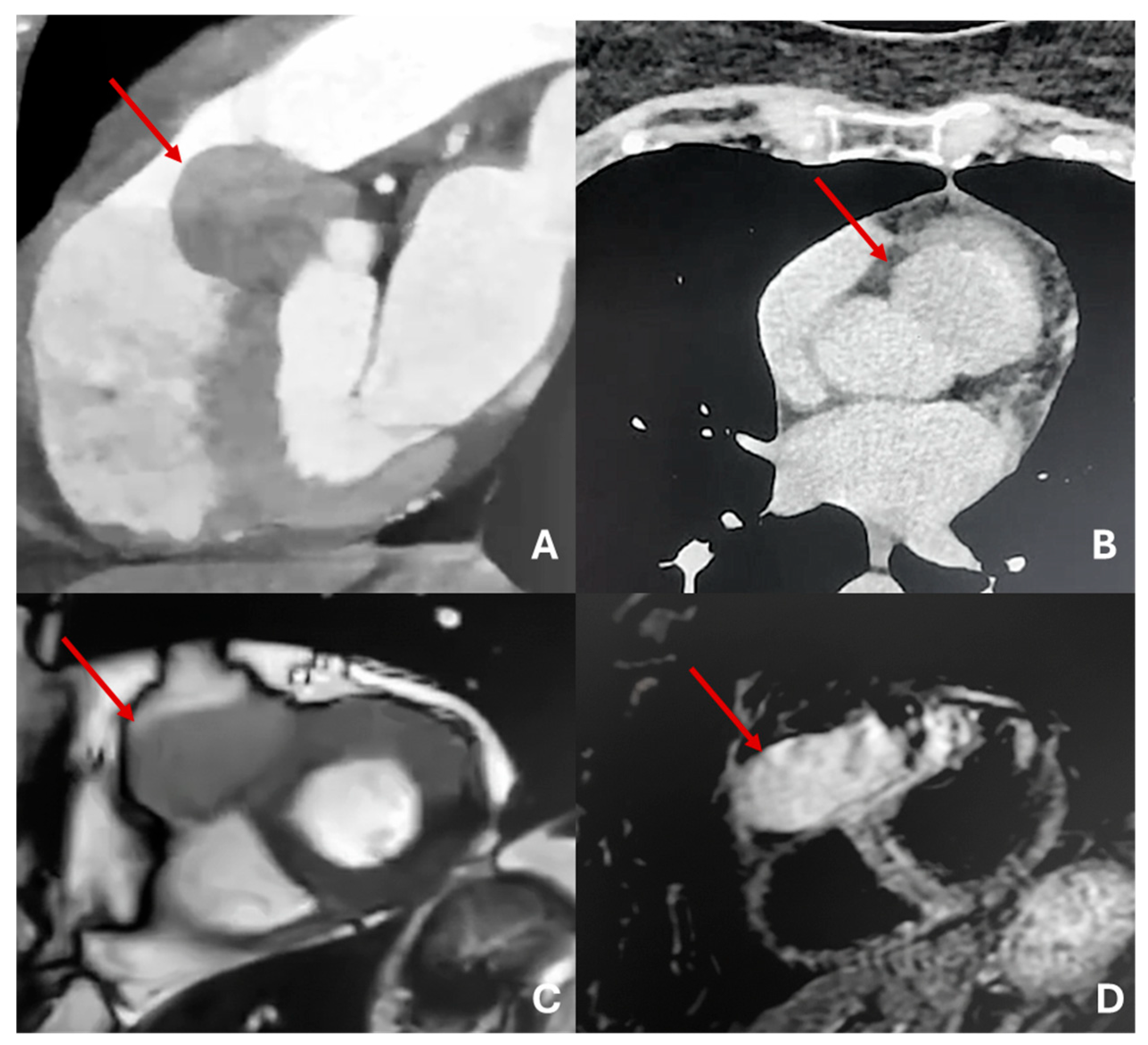 Preprints 175995 g011