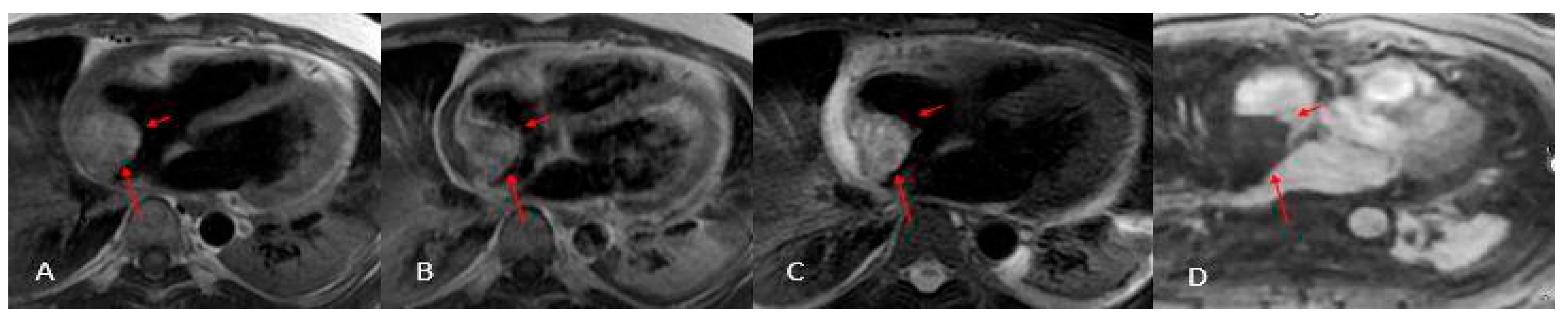 Preprints 175995 g013