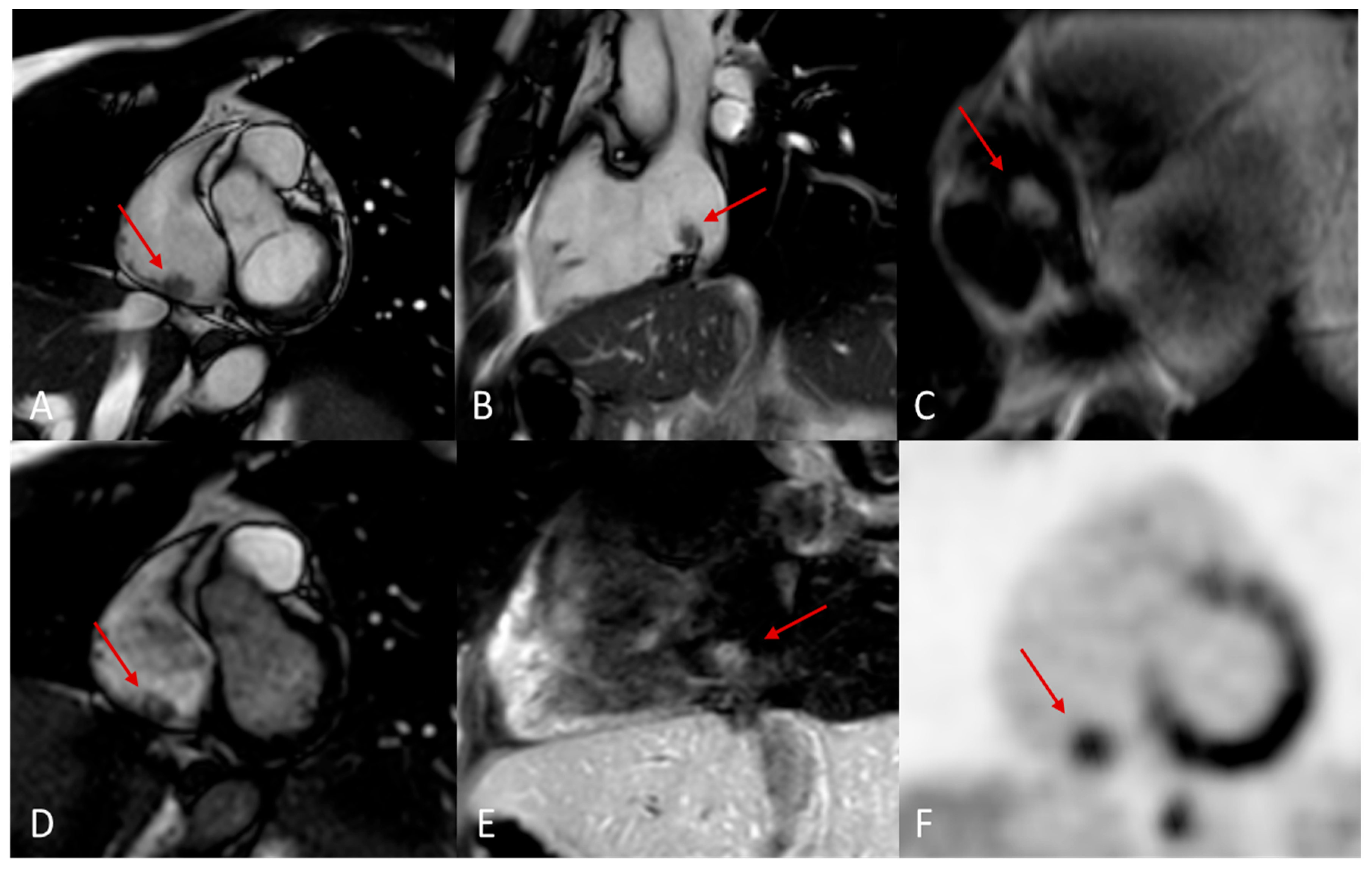 Preprints 175995 g014