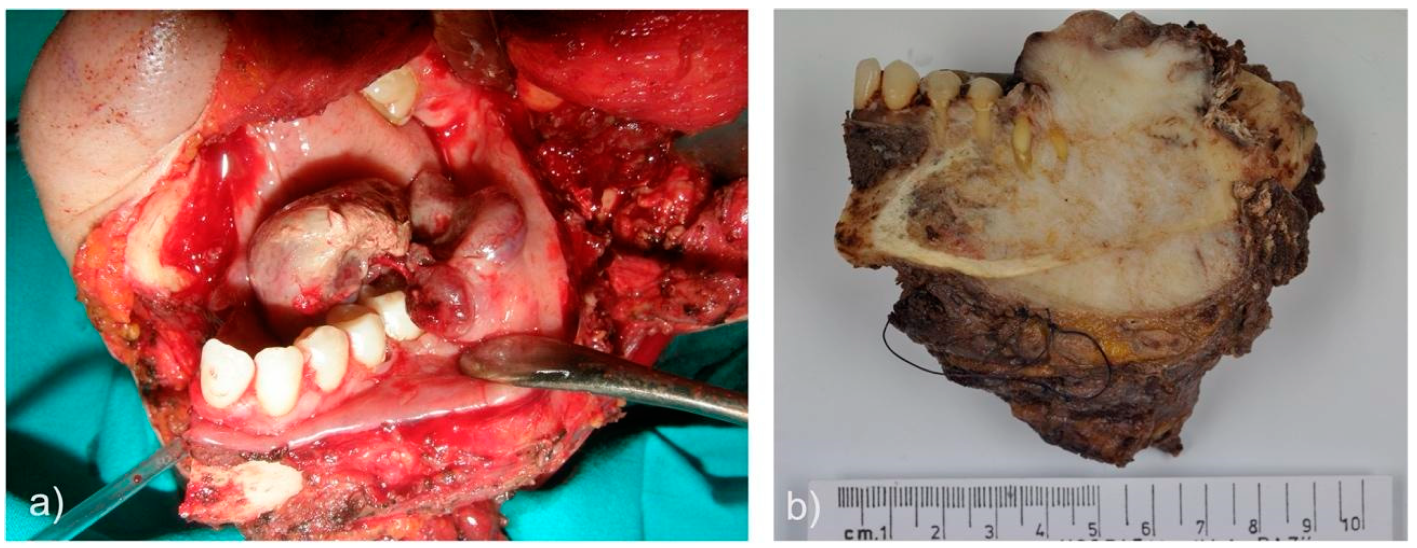 Preprints 75305 g003