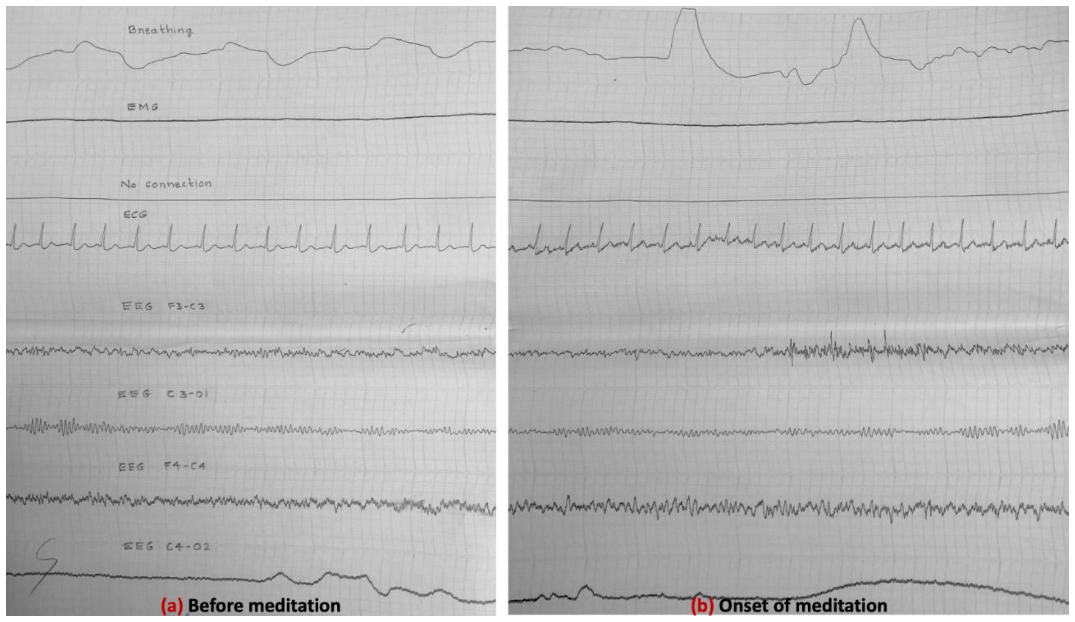 Preprints 157147 g004