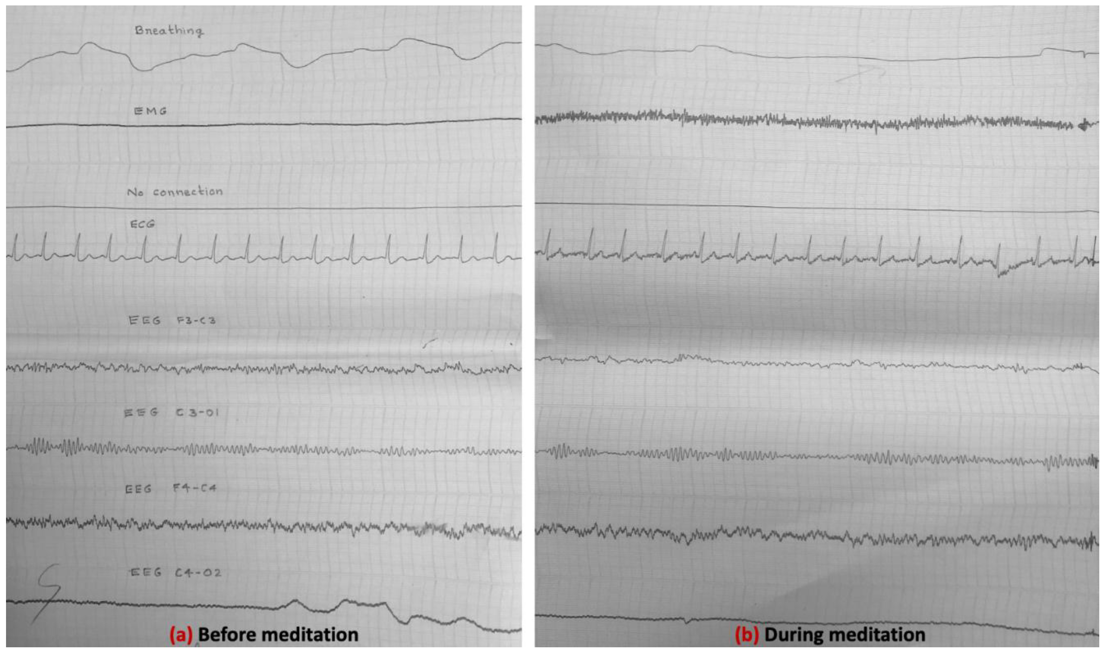 Preprints 157147 g005