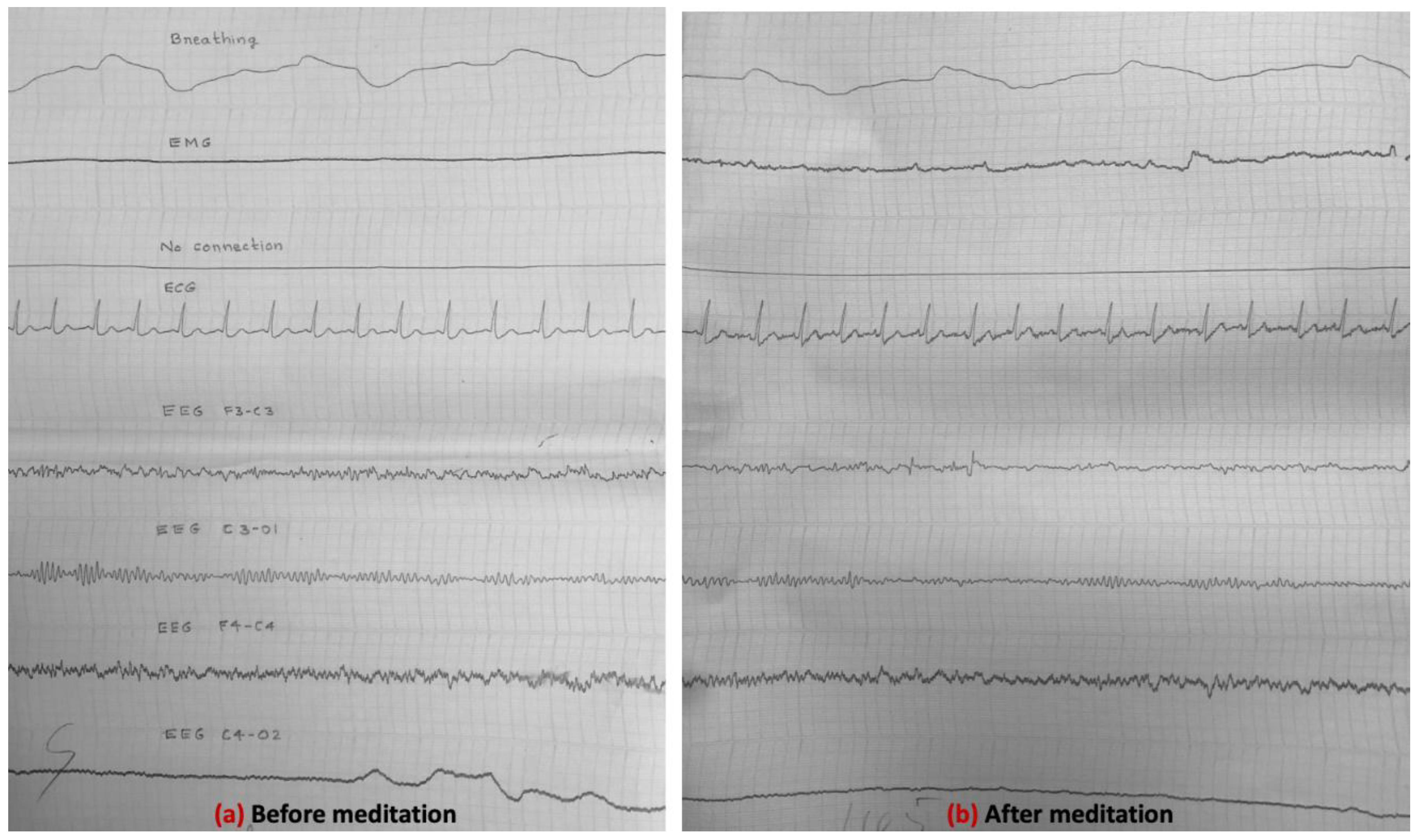 Preprints 157147 g006