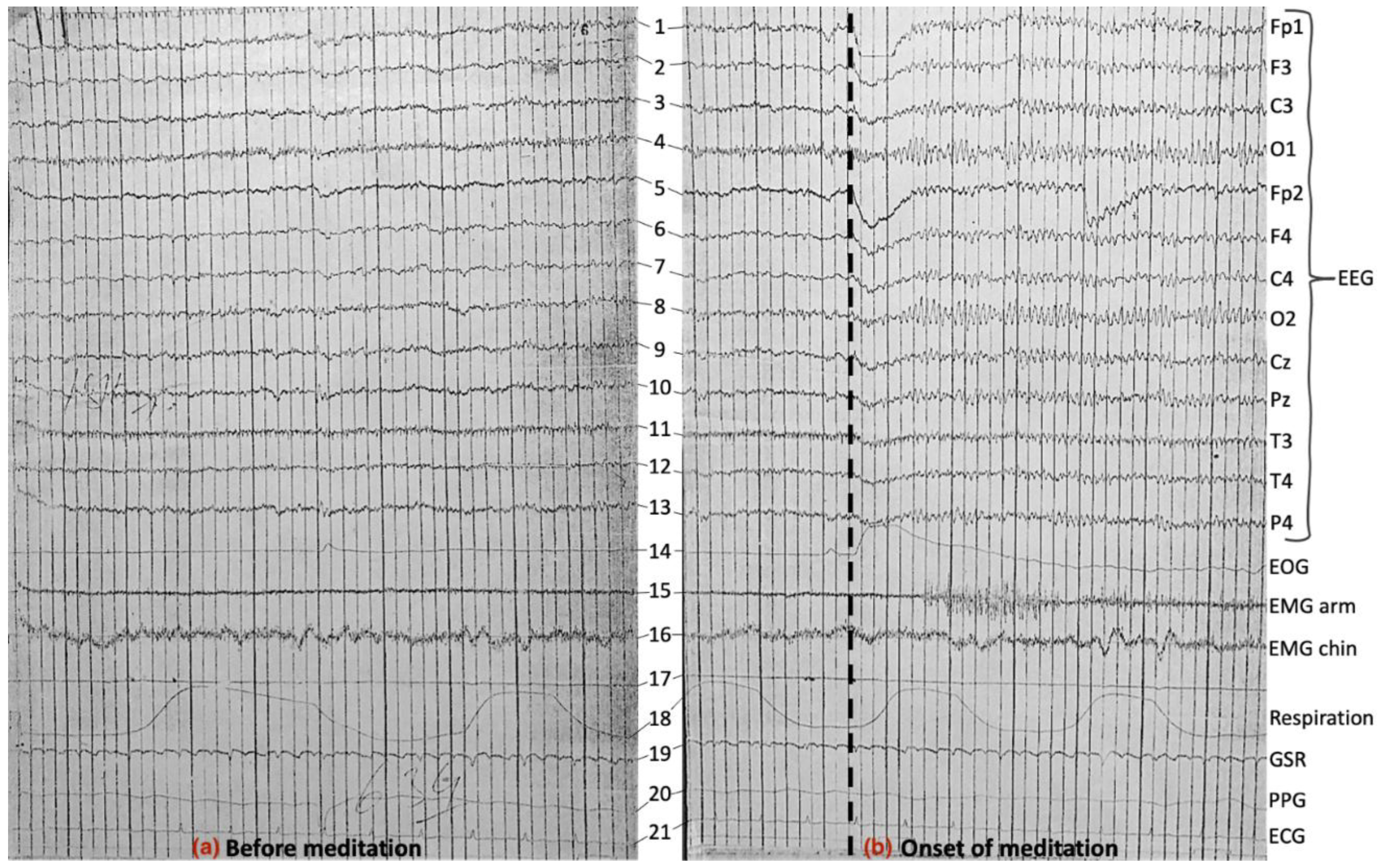 Preprints 157147 g008