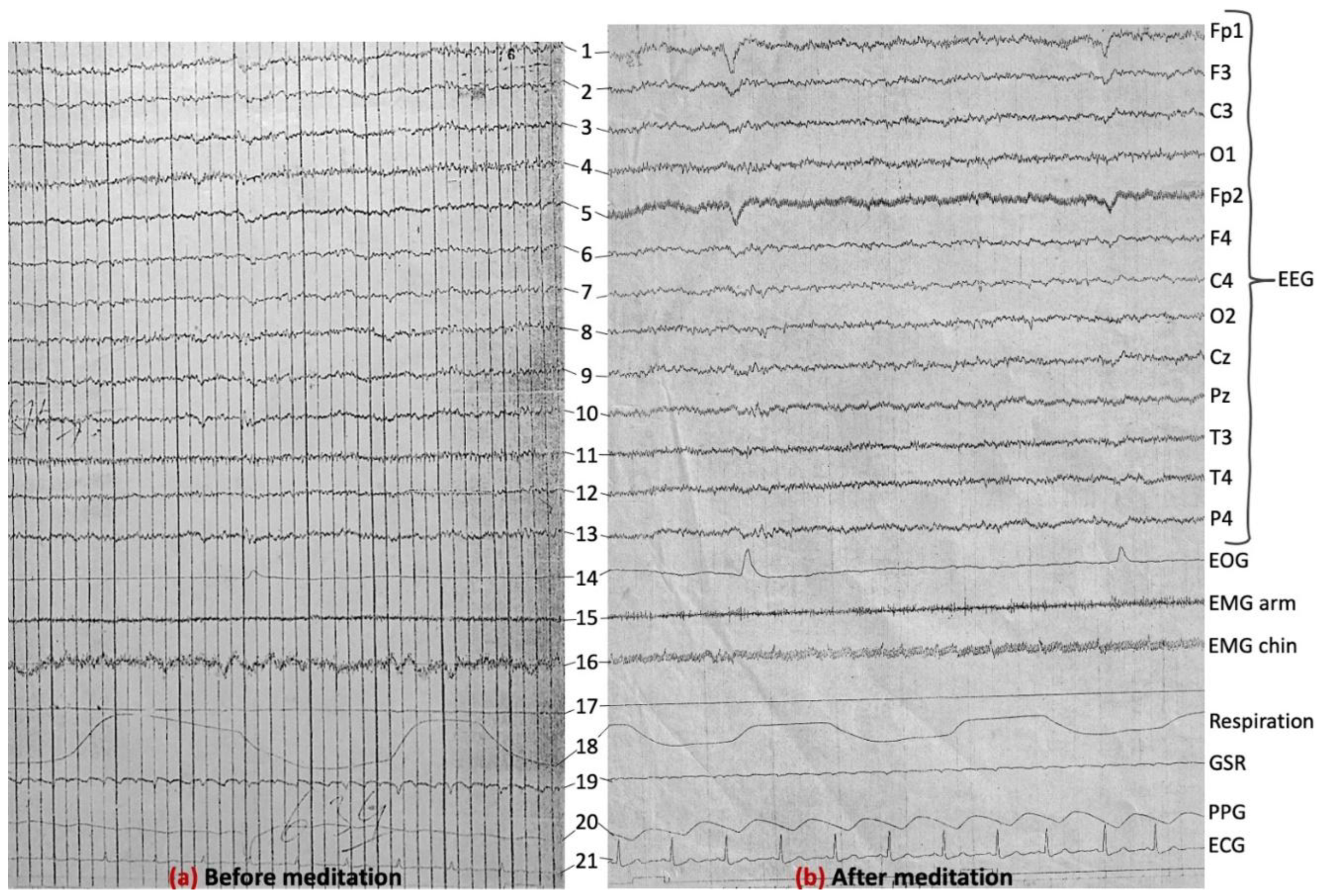 Preprints 157147 g010