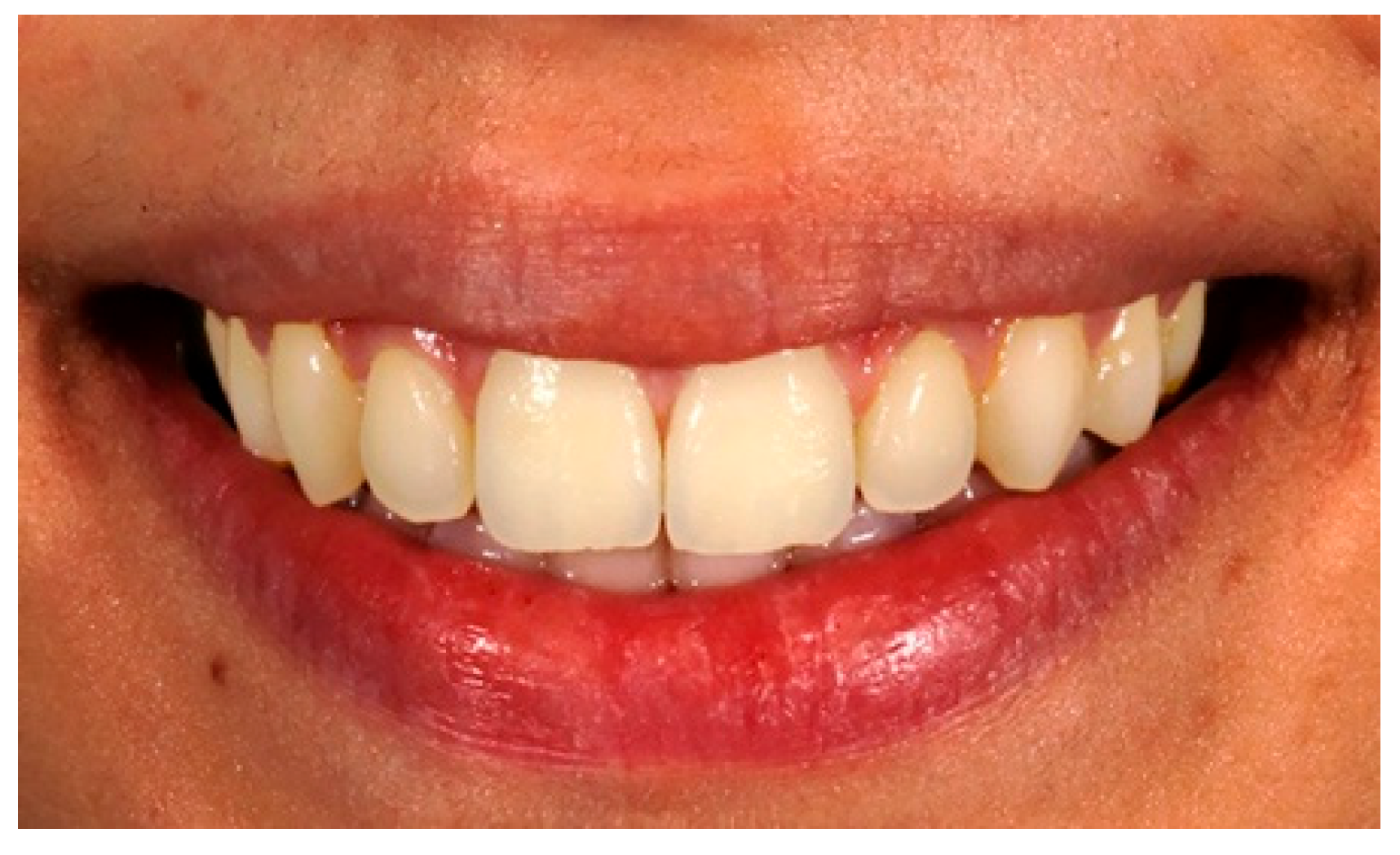 Preprints 160265 g002