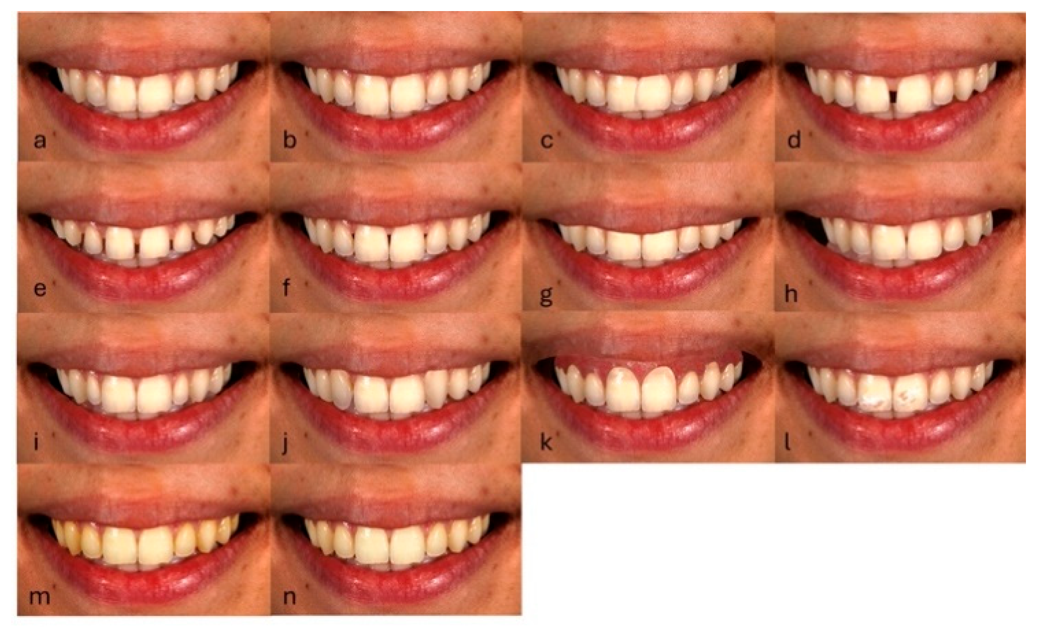 Preprints 160265 g003