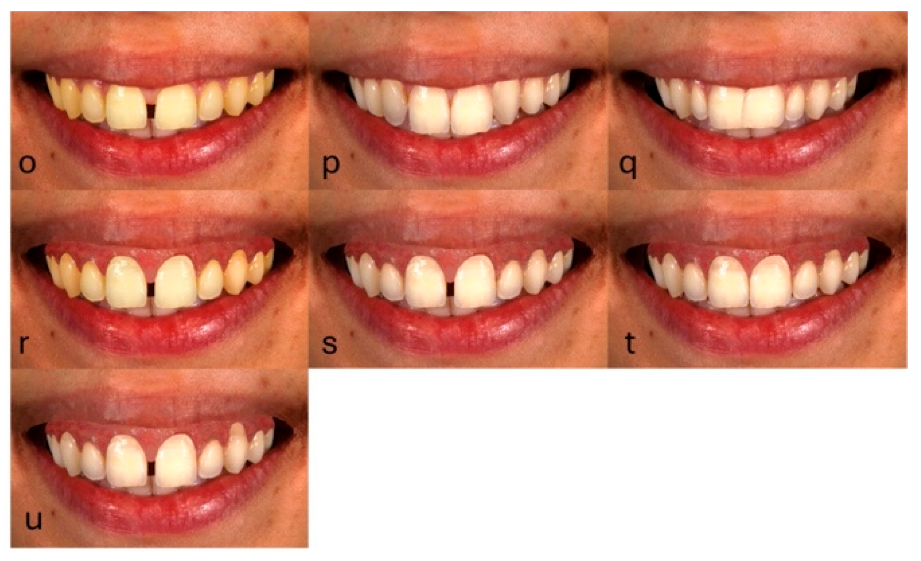 Preprints 160265 g004