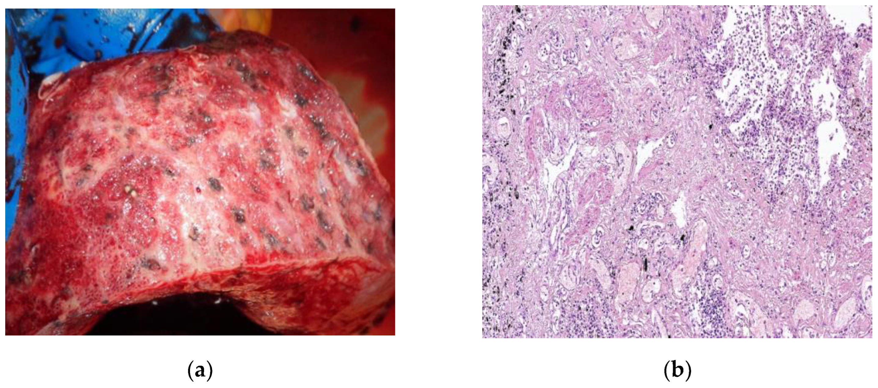 Preprints 72148 g004
