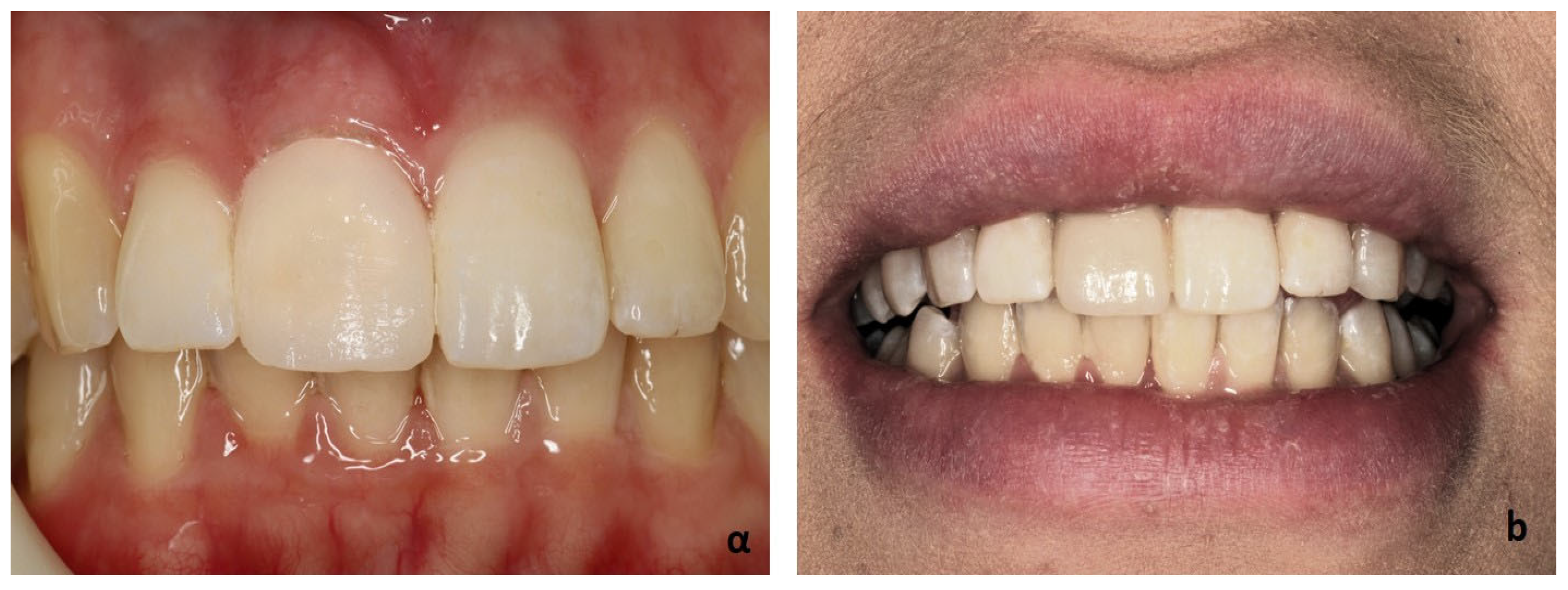 Preprints 117327 g004