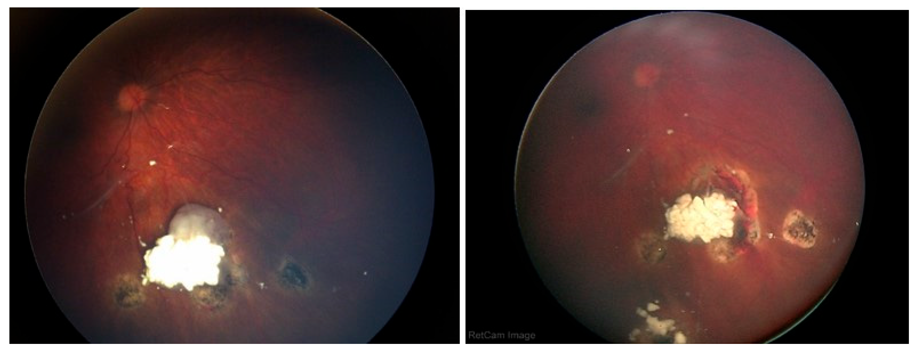 Preprints 169817 g005