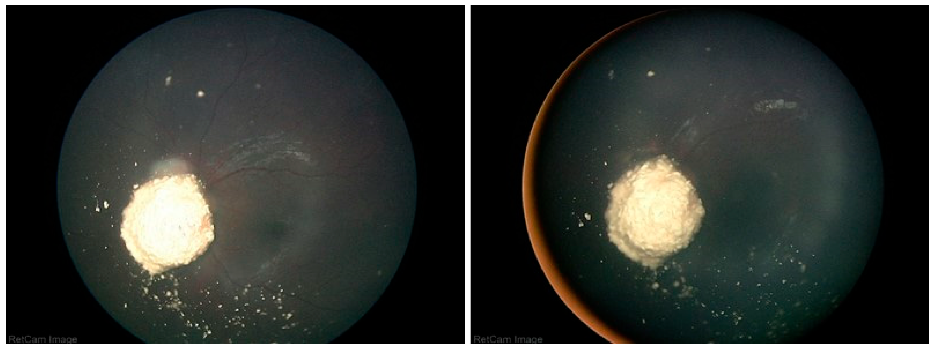 Preprints 169817 g006