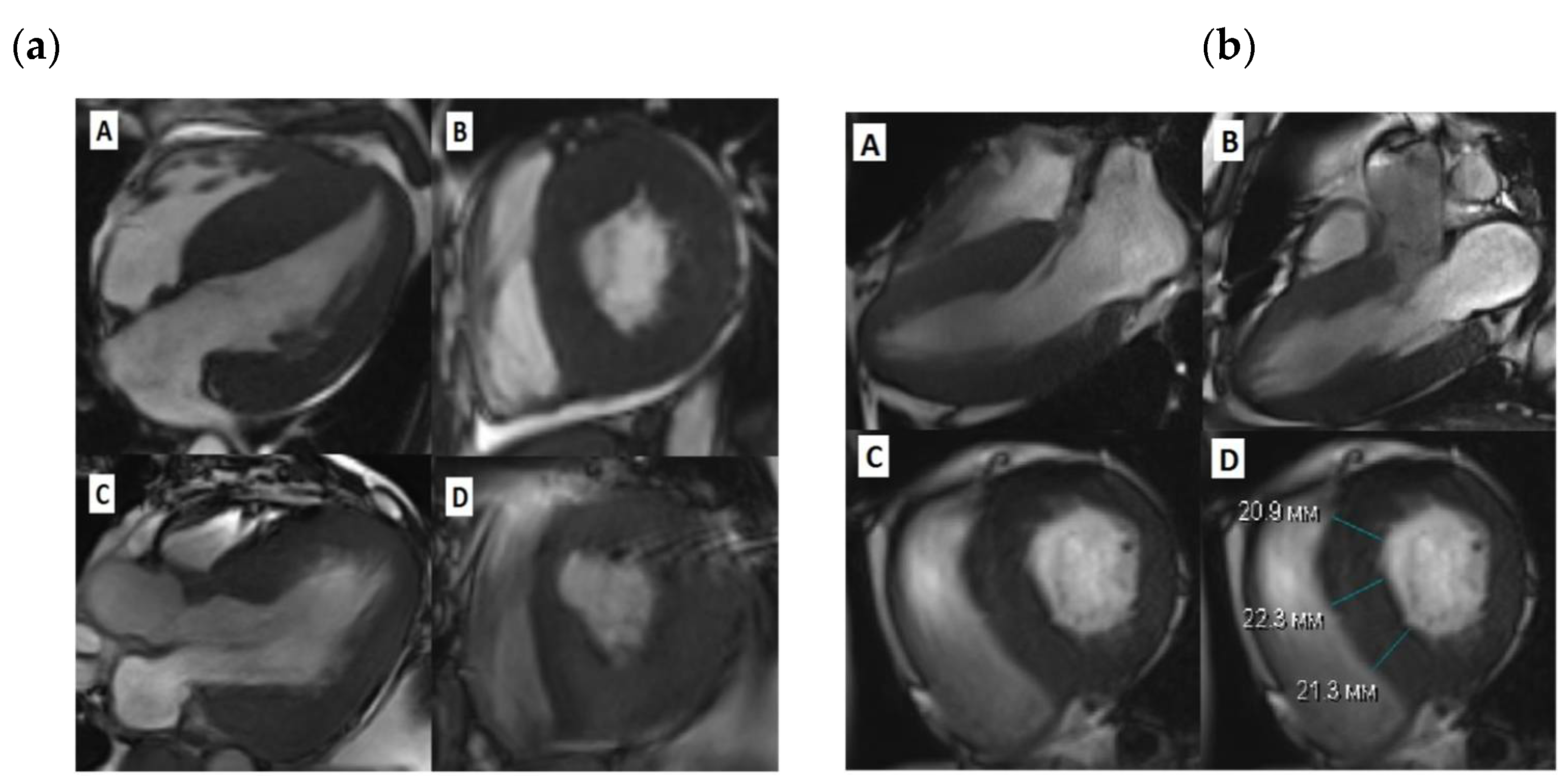 Preprints 112006 g001