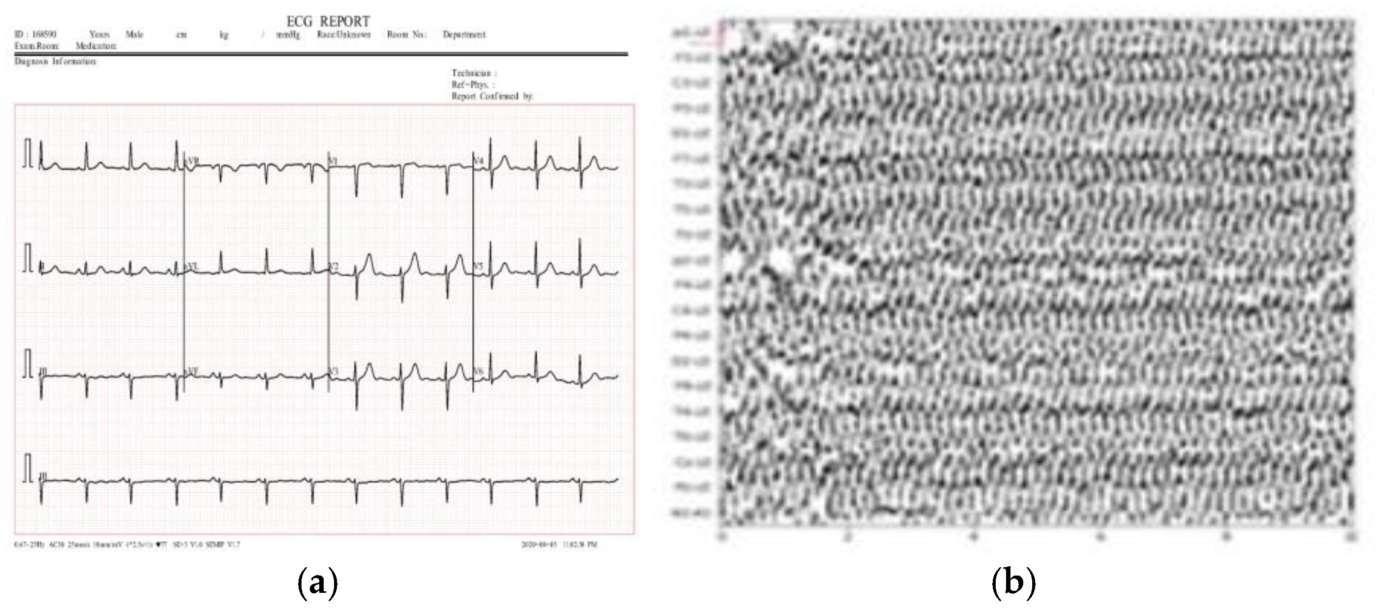 Preprints 147816 g017a