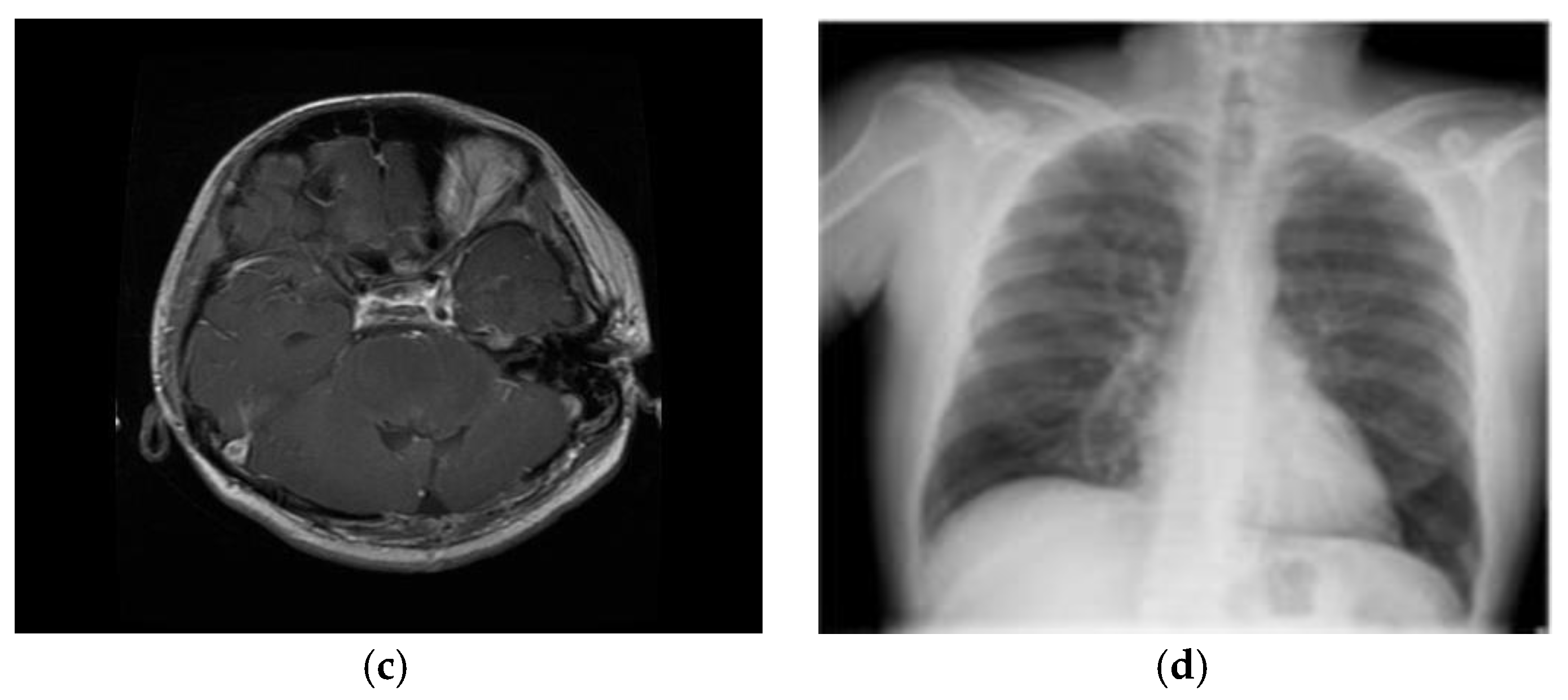 Preprints 147816 g017b