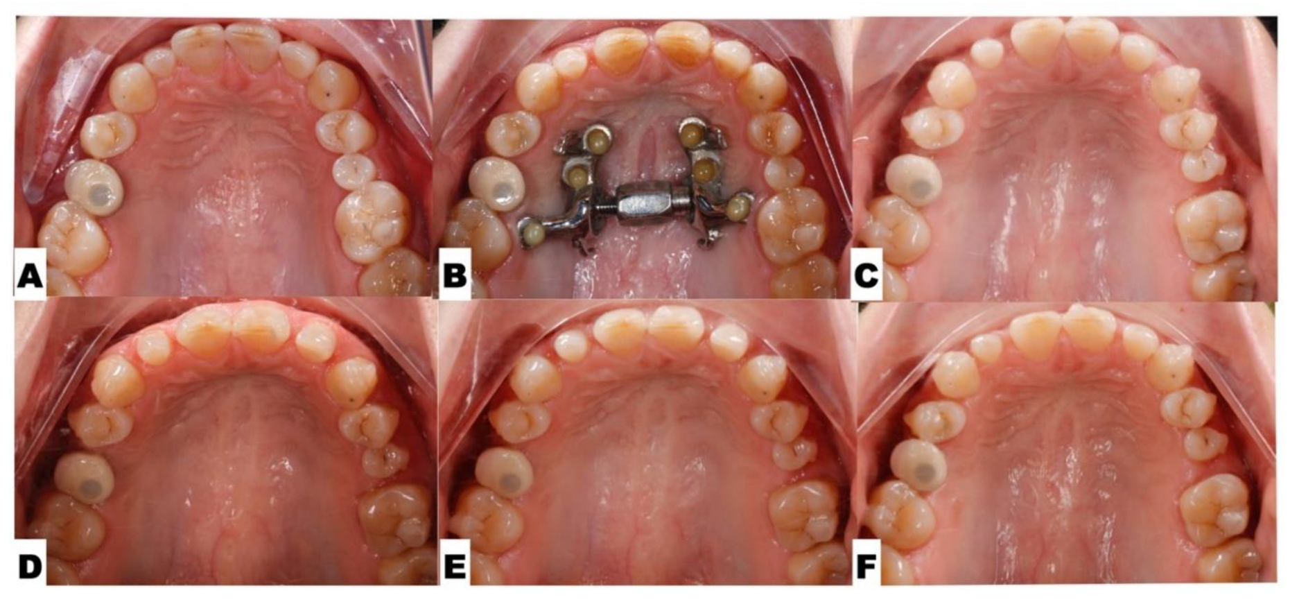 Preprints 177474 g013