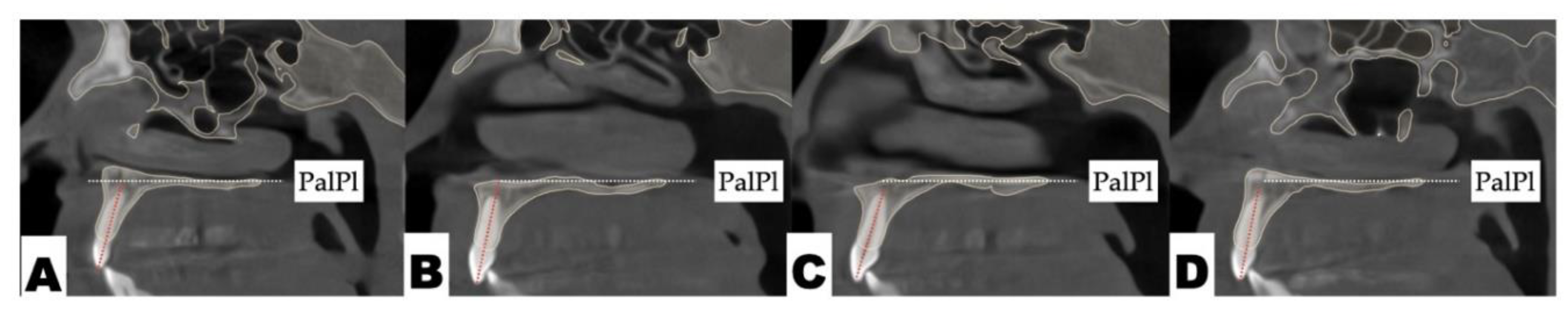 Preprints 177474 g014